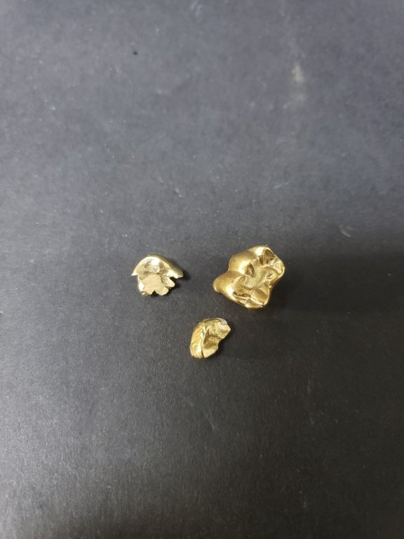009 - Lot 160 - Dental gold.jpg
