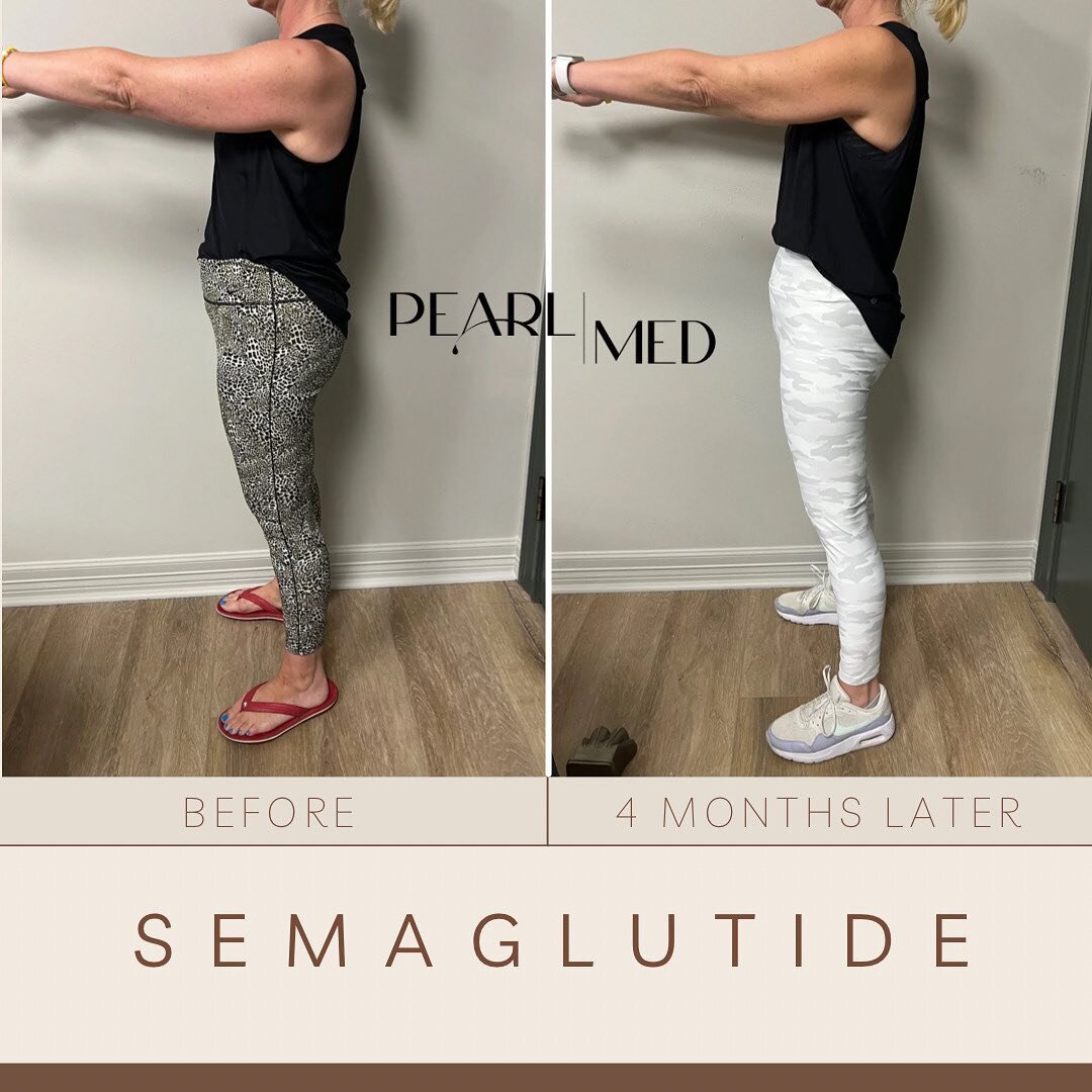 4 months apart. 27 pounds later! Pearl Med has it!
⠀⠀⠀⠀⠀⠀⠀⠀⠀
⠀⠀⠀⠀⠀⠀⠀⠀⠀
#weightloss #beforeafter #semaglutide #GLP1 #pearlmedtx #health #wellness #beaumonttx #medspatx
