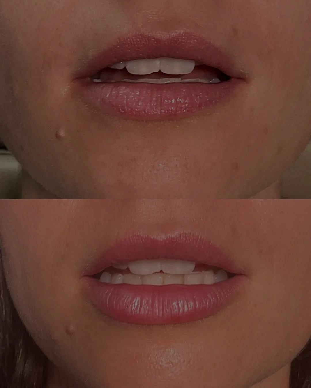Lip love