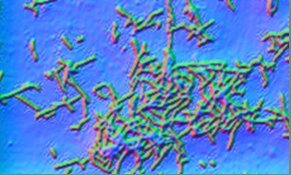 Gram-stainlight-microscopic-colored-image-of-Actinobacteria-Actinomyces-STII_W640.jpg