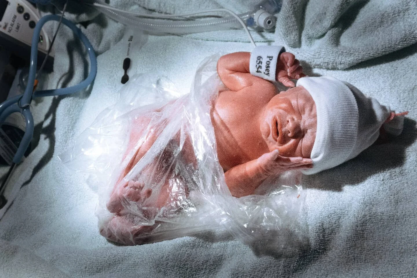 Some babies cannot wait to come into this world! 
A fierce and resilient momma brought this little peanut into the world yesterday 💙

-
-
-
-
-
-
-
-
#newborn #preterm #nicu #newmom #newdad #doula #birthdoula #birthisbeautiful #fraservalley #support