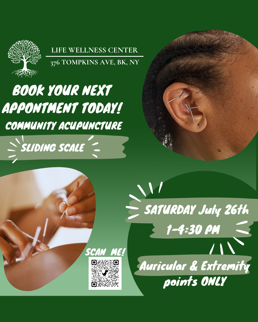 Community Acupuncture