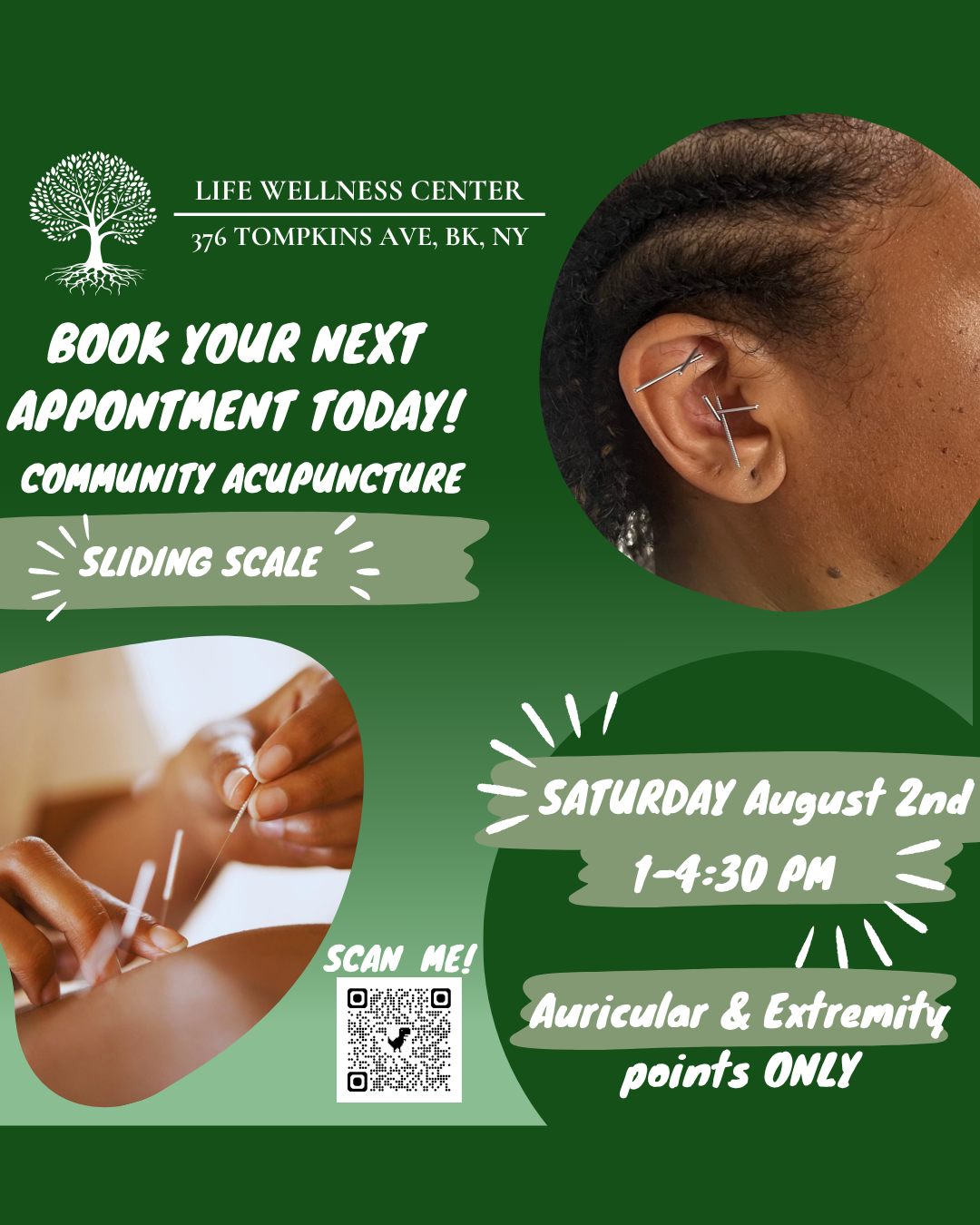 Community Acupuncture