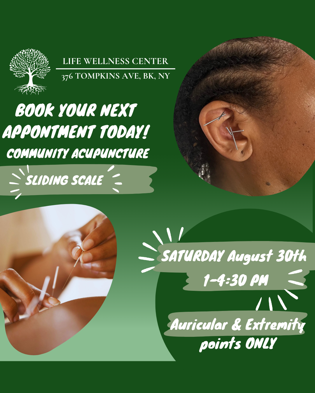 Community Acupuncture