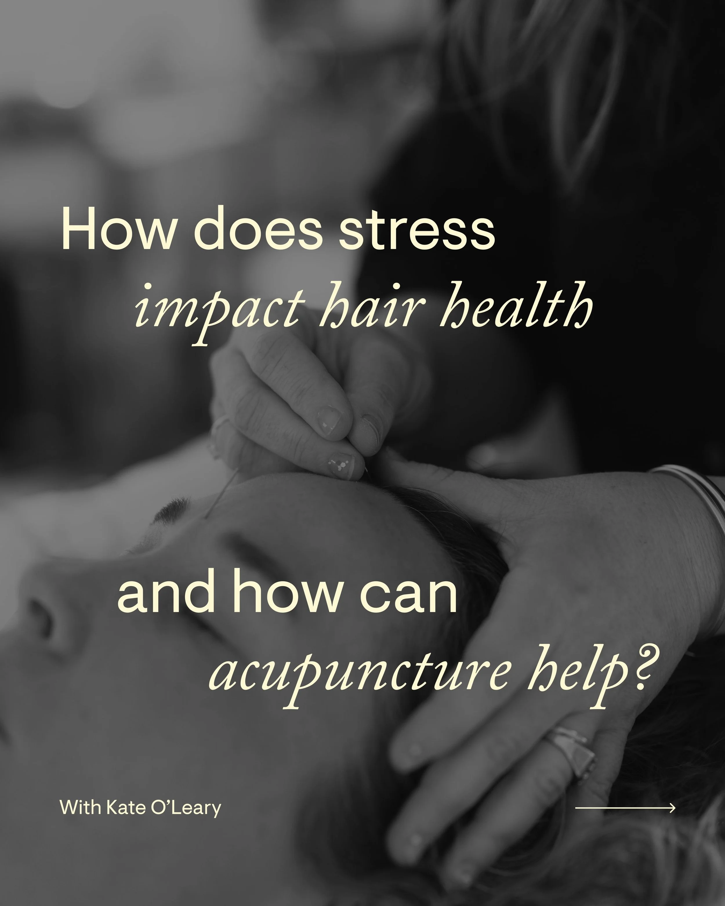 How does stress impact hair health, and how can acupuncture help?

We spoke with Kate to explore her practice and gain a deeper understanding of acupuncture, and how it can support hair health from within. Swipe for more questions &rarr;

Are you int