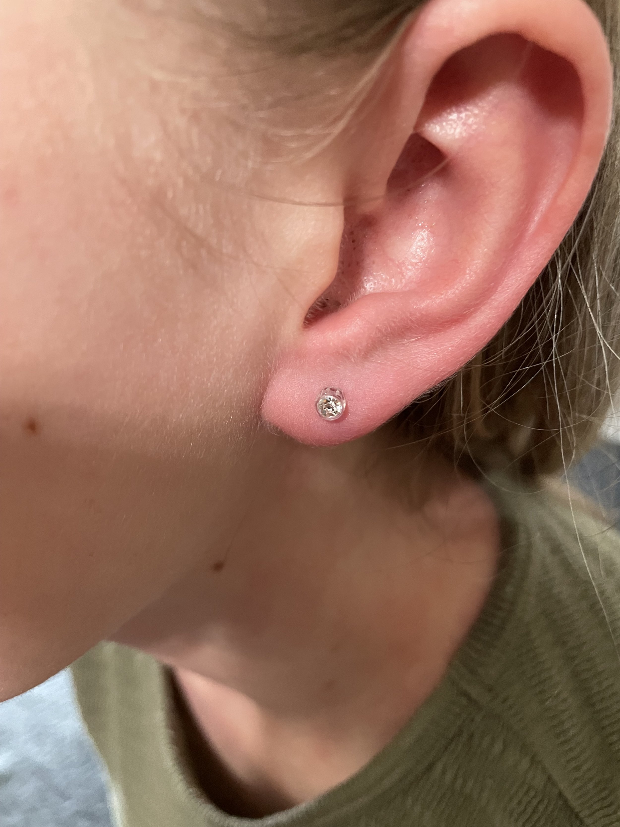 Blomdahl Medical Grade Ear Piercing: Client Photo