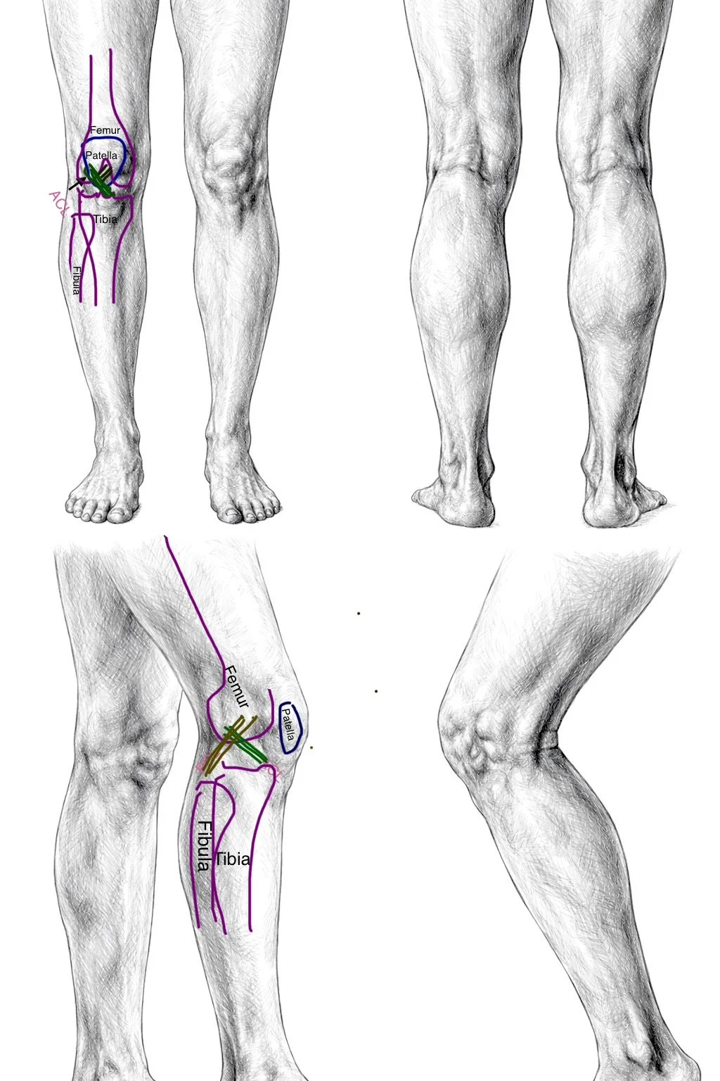 How much does ACL surgery cost in the UK?
