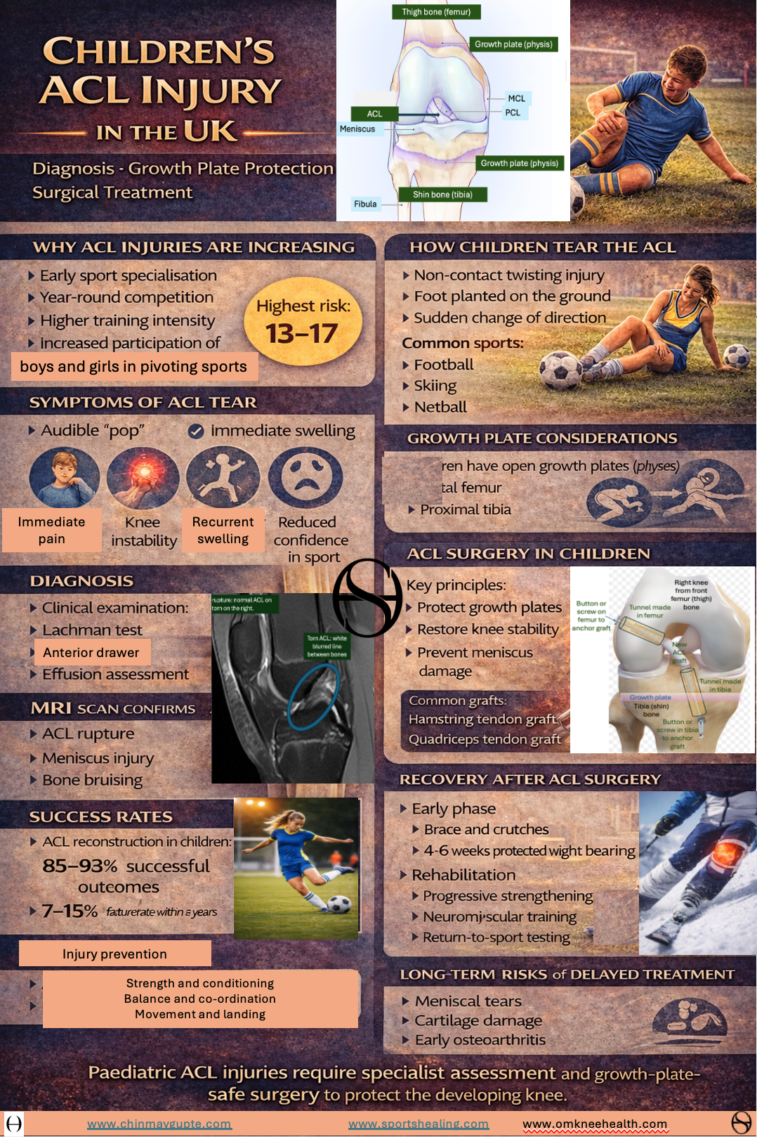 Children's ACl injury Uk infographic