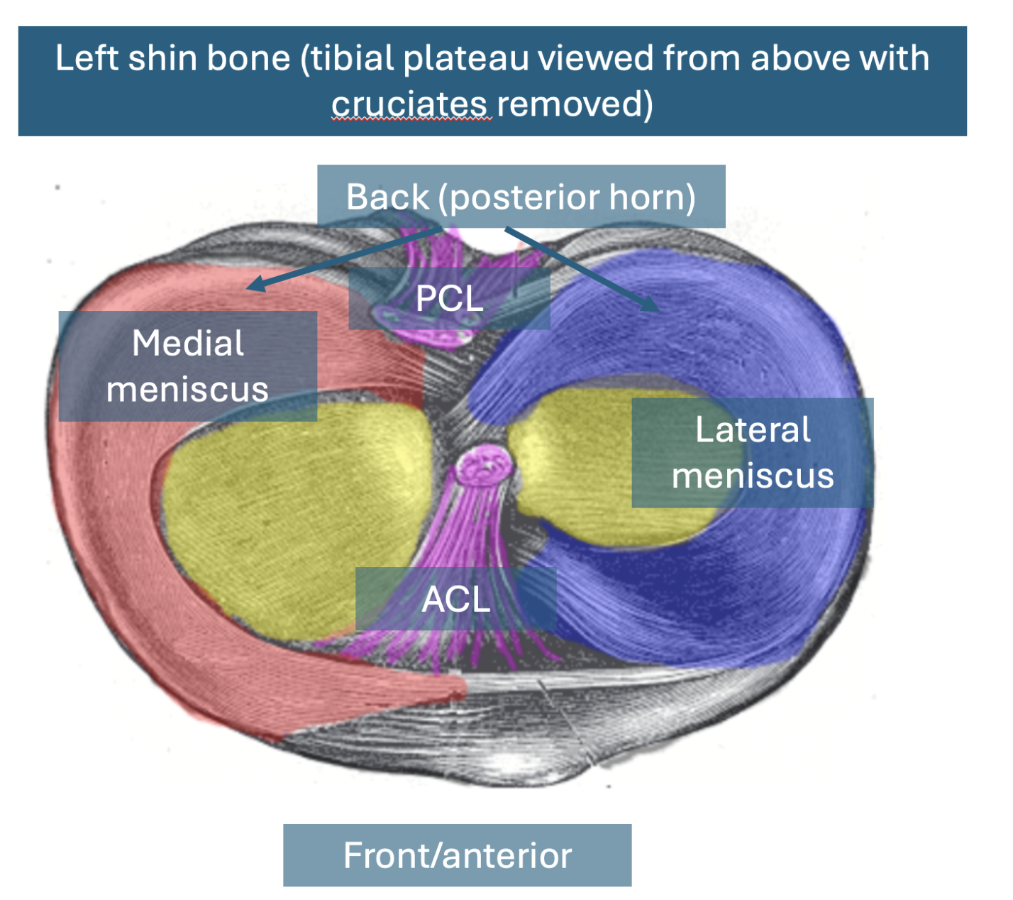 Meniscal Tear Treatment in the UK: Evidence-Based Options, Costs and When Surgery Is Necessary (2026 Definitive Guide)
