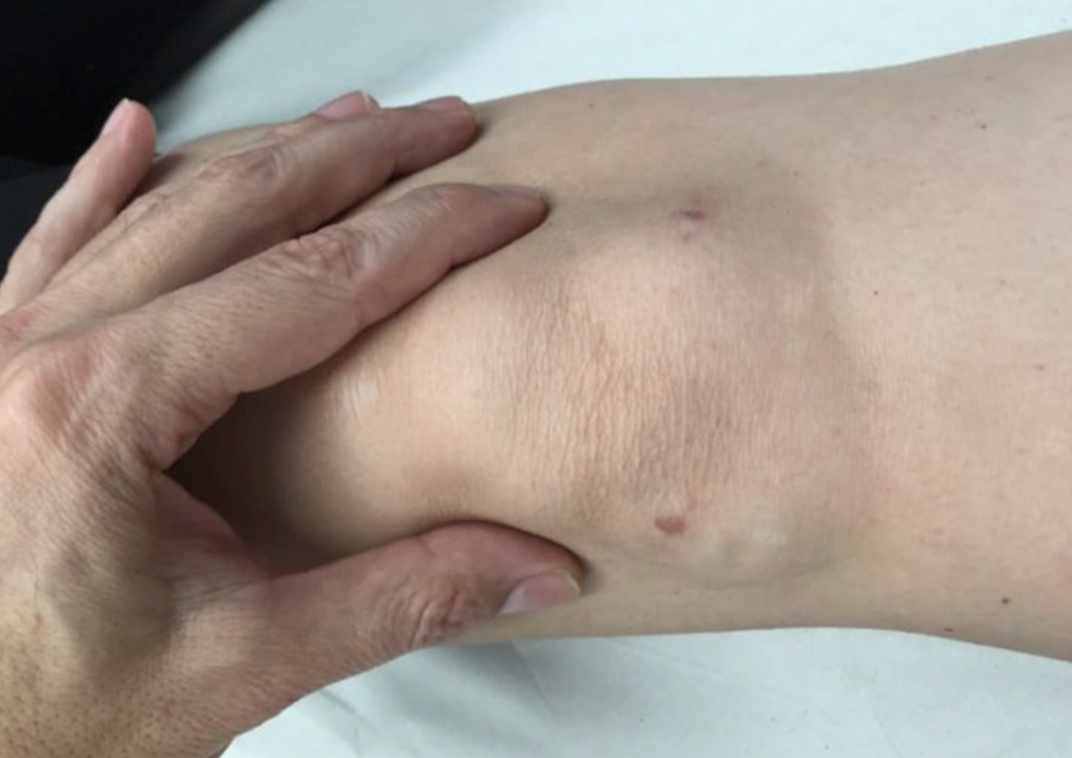 What causes a sharp pain on the outside-inside of my knee?