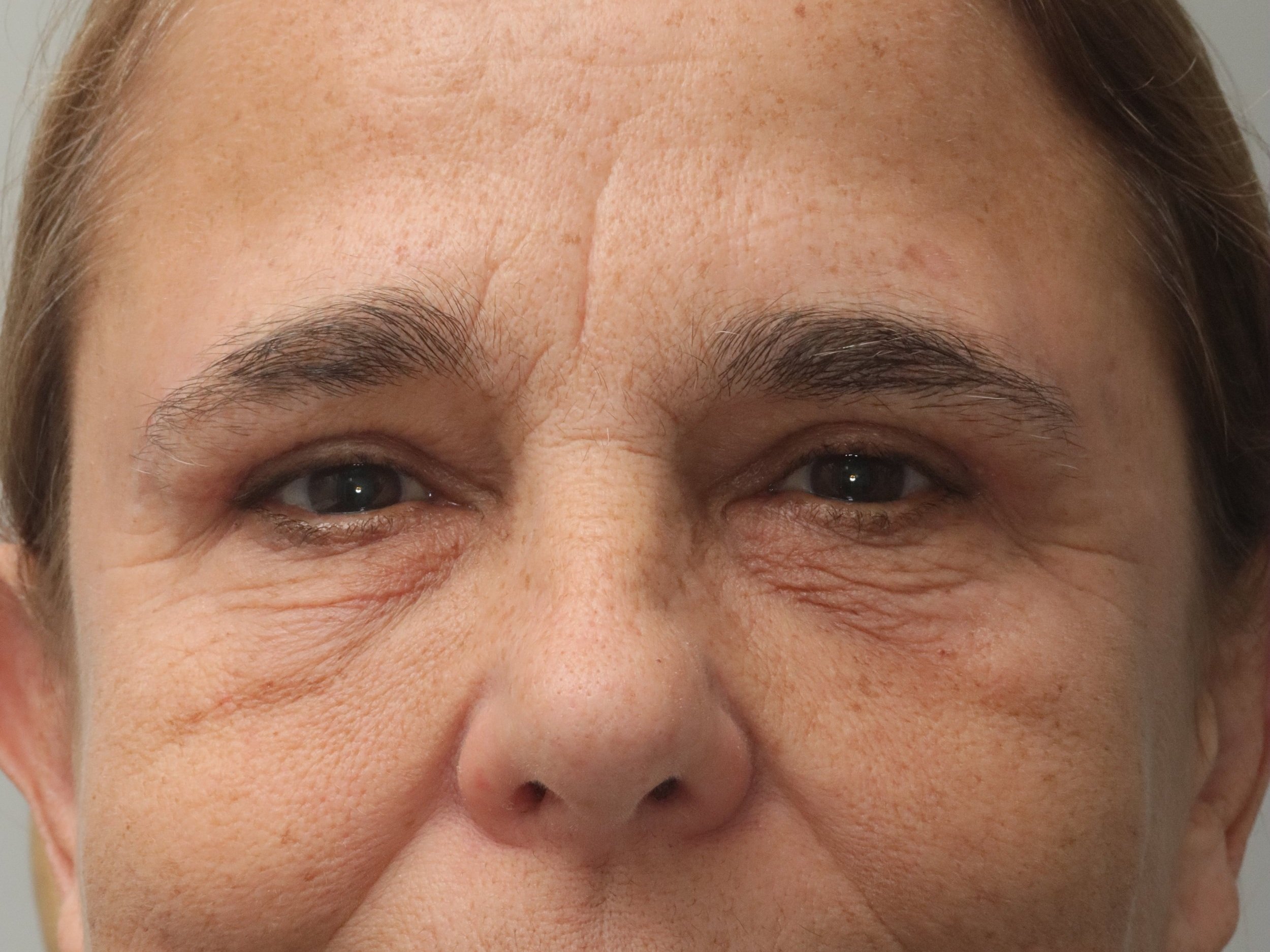 BUL+BLEPH+AND+BROW+after.jpg
