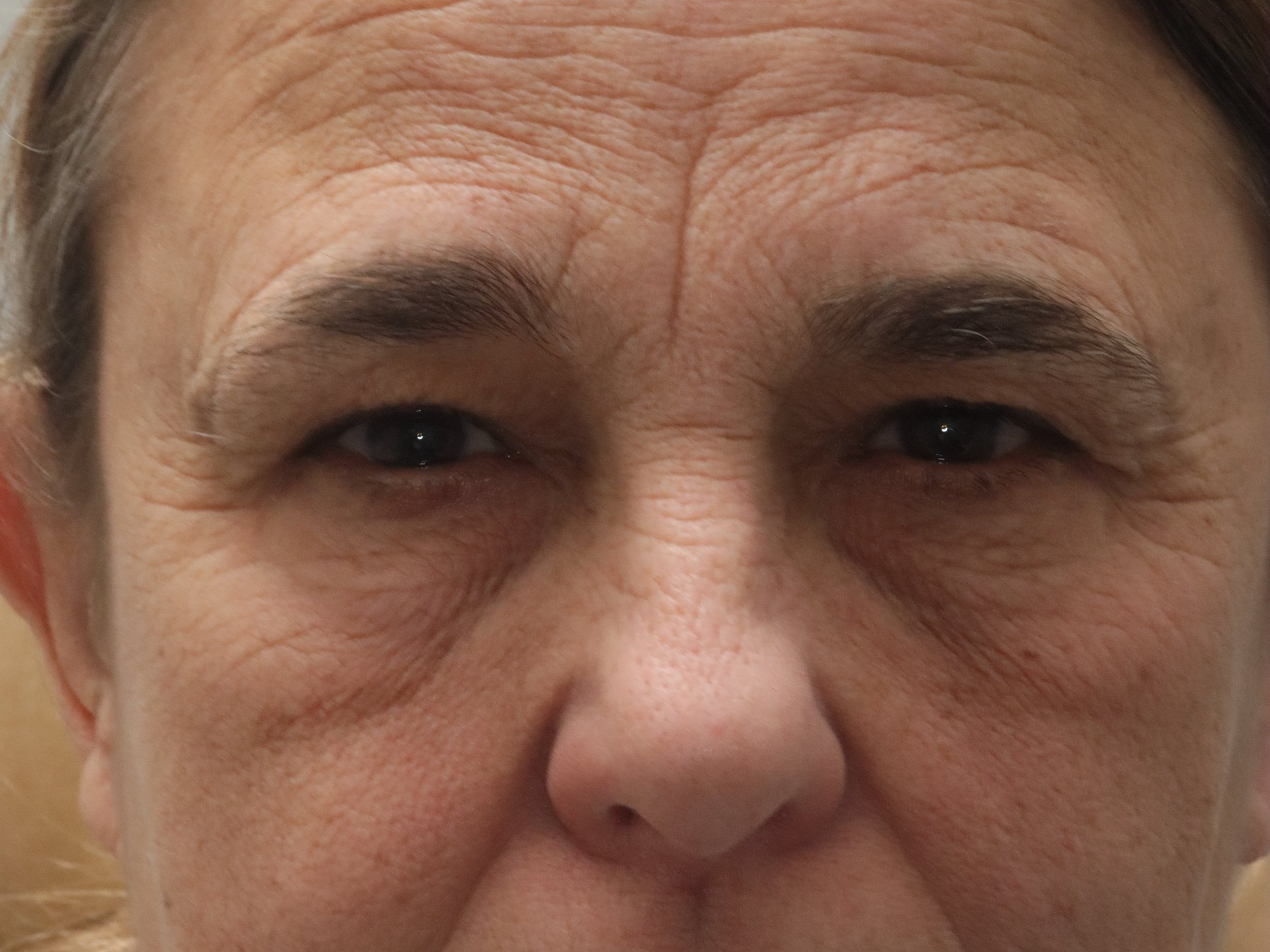 BUL+BLEPH+AND+BROW+BEFORE.jpg
