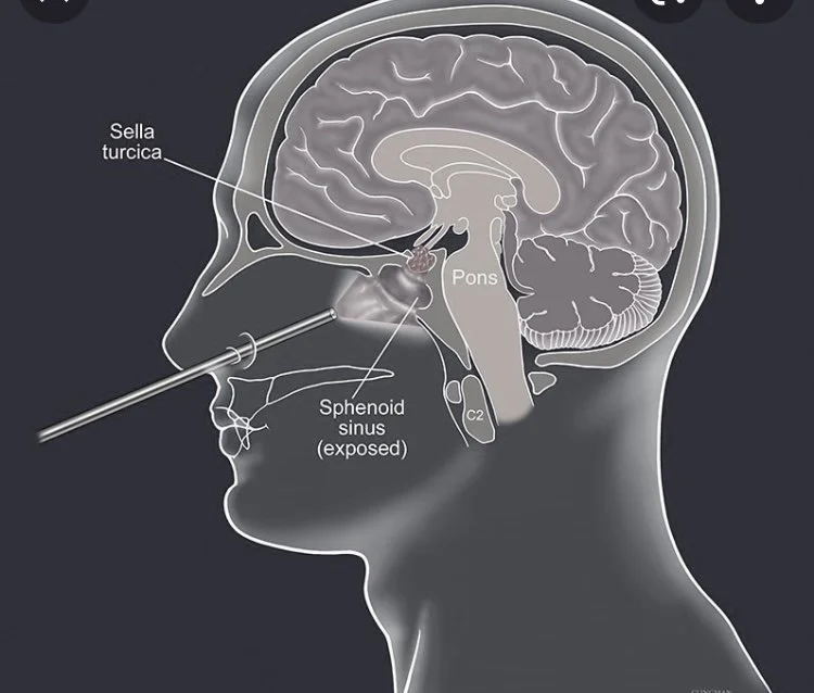 Pituitary Surgery Course