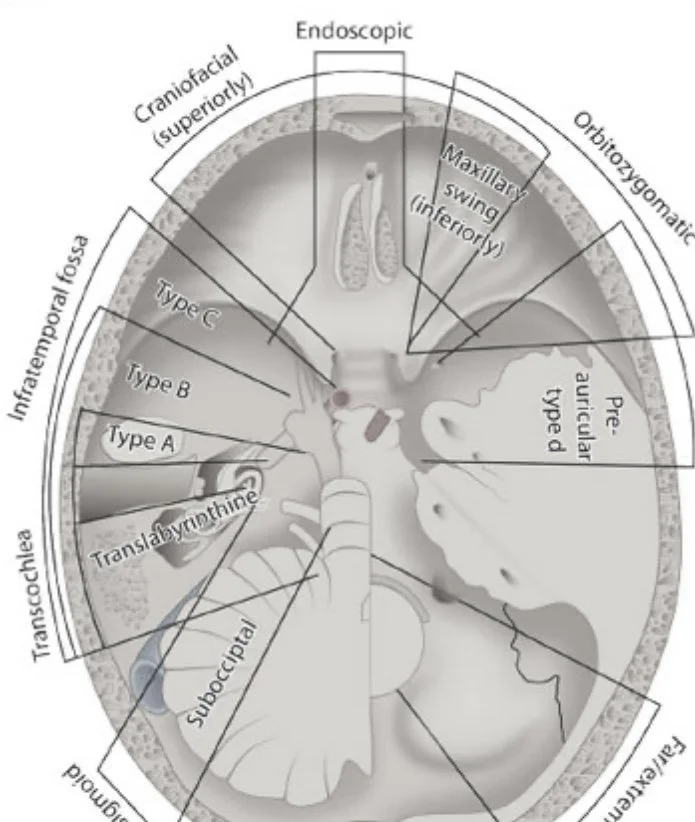 Lateral Skull Base Approaches Course 