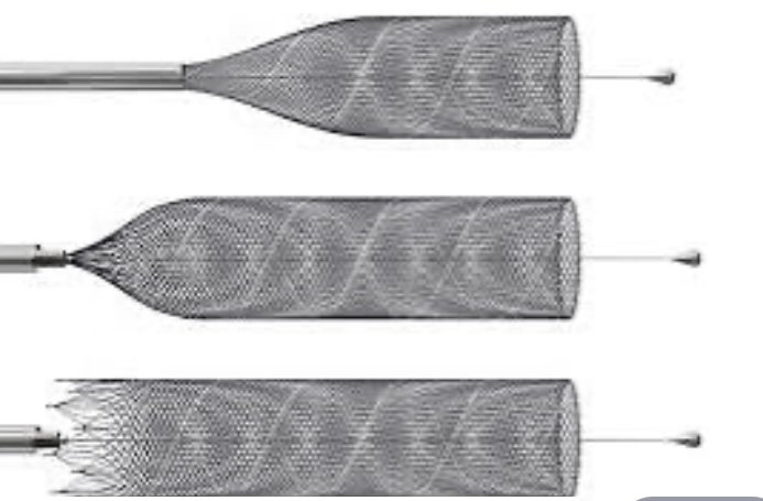 P64 Flow Modulating Stent Workshop