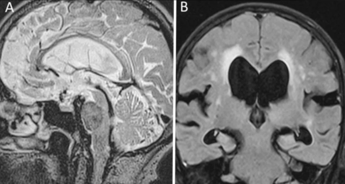 The UK CSF Advisory Group Meeting 