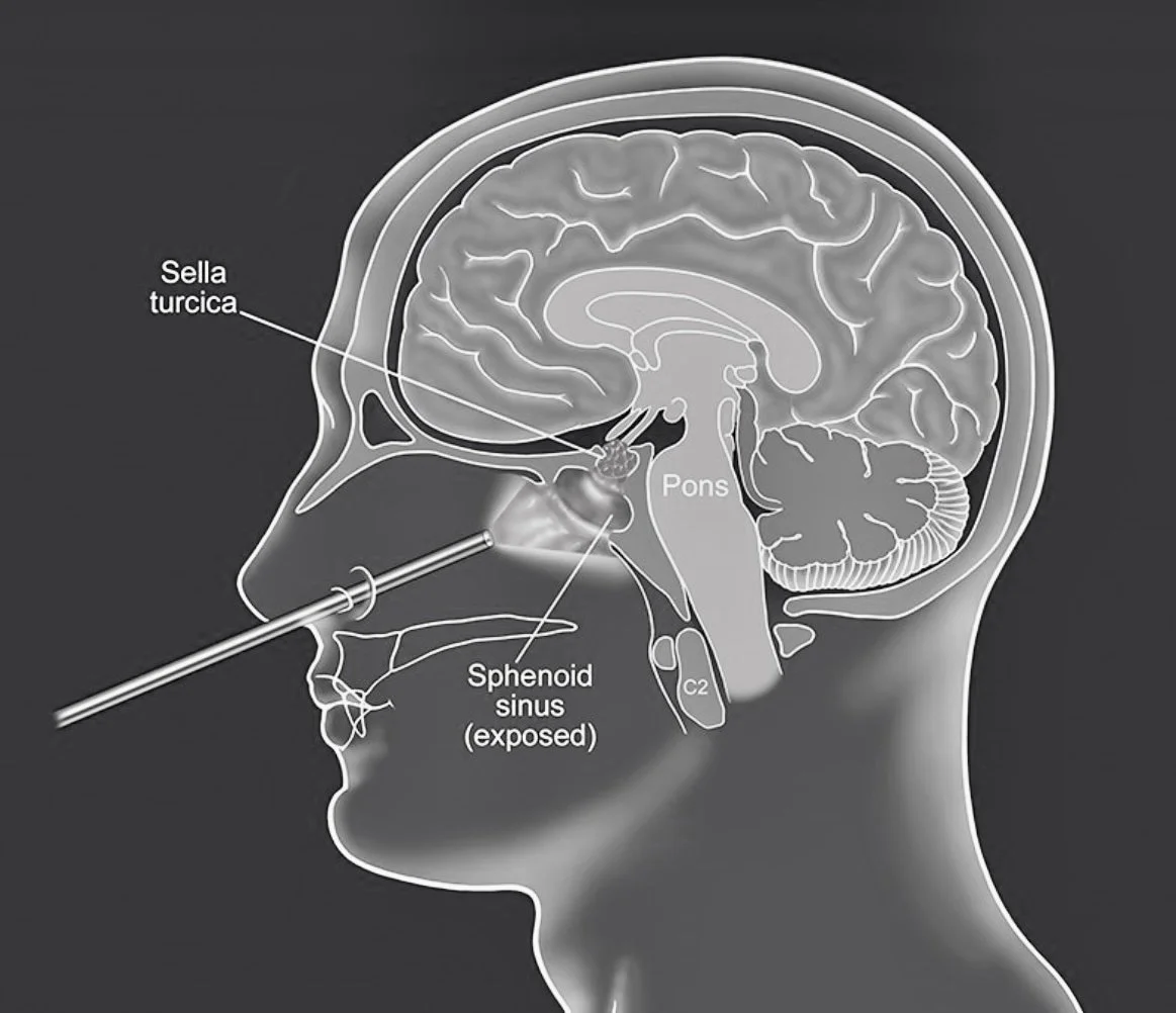 Pituitary Surgery Course