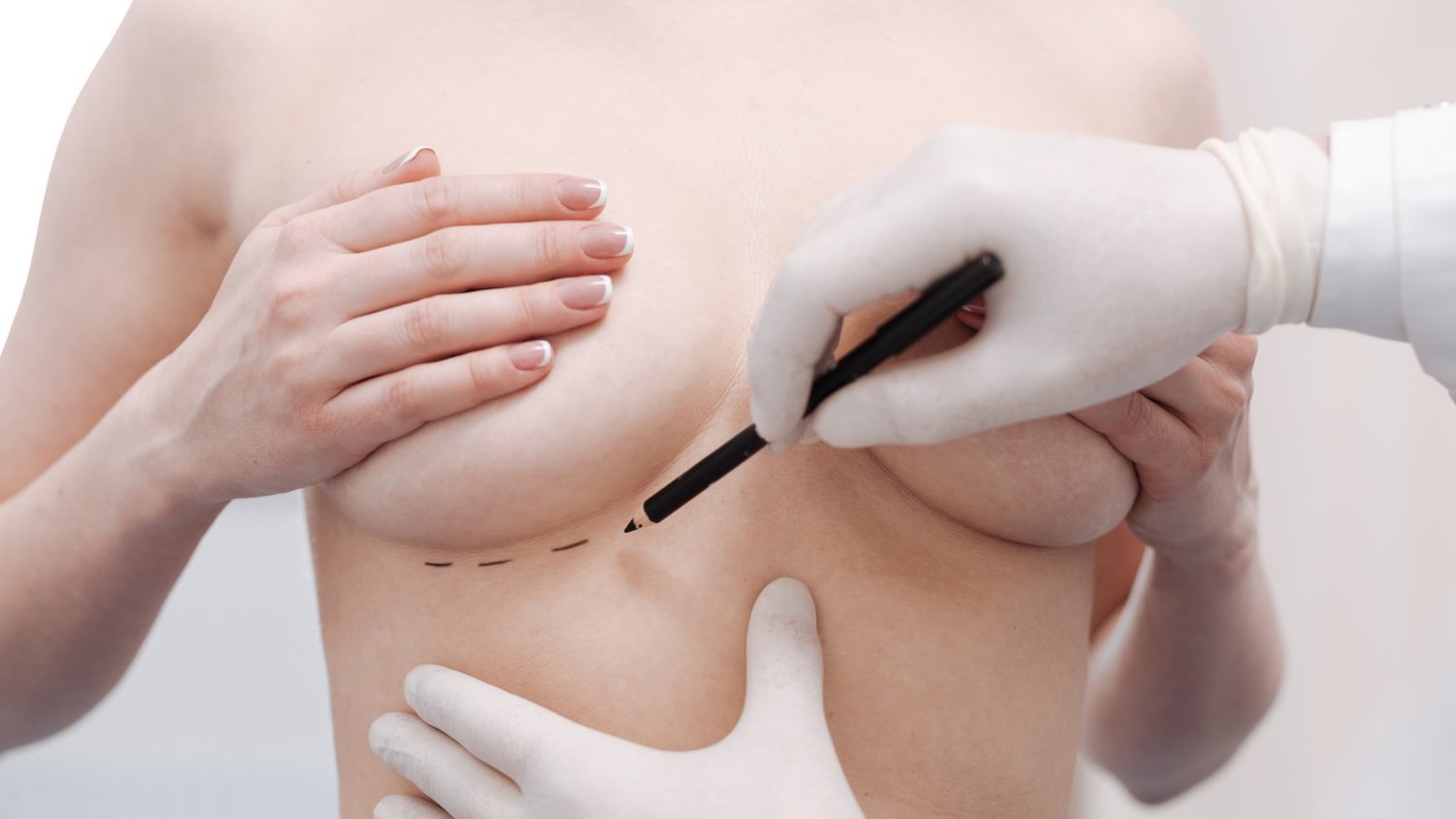 Breast shaping