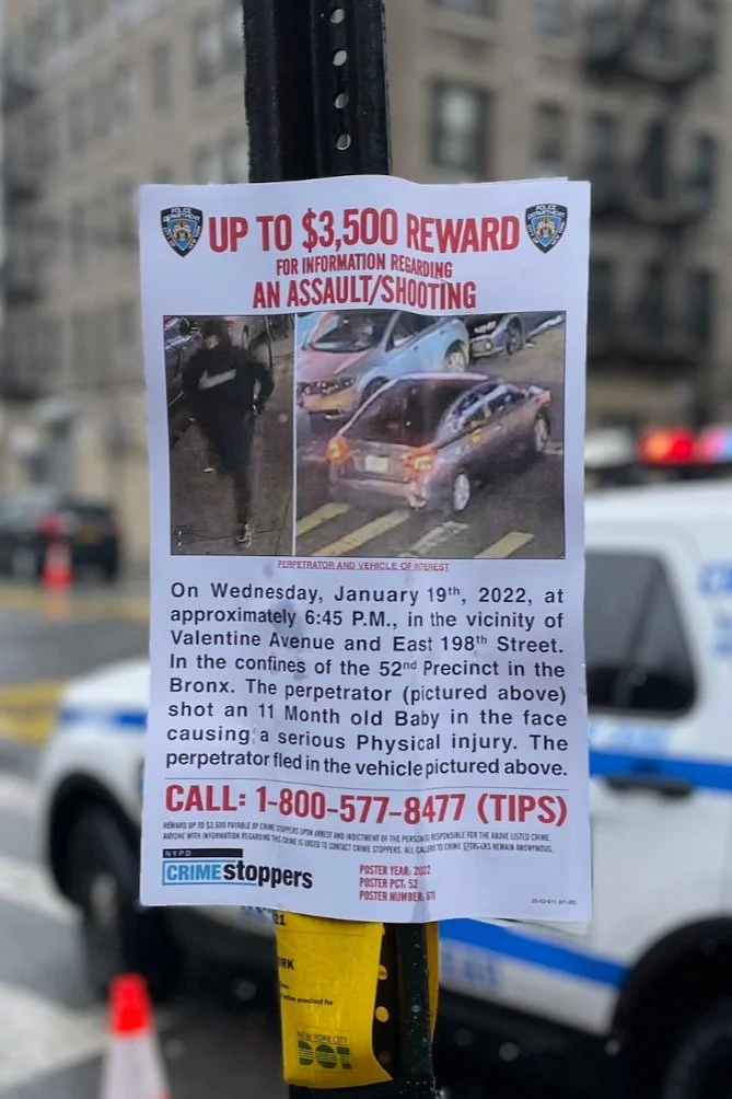 11-Month-Old Girl Shot in Face by a Stray Bullet, Remains in Critical but Stable Condition