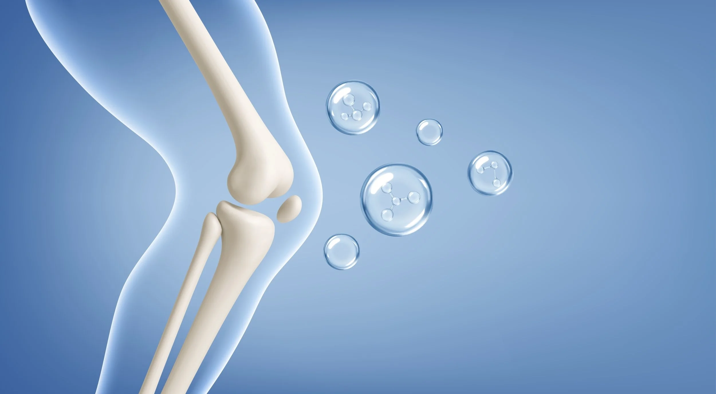 Ilustración de rodilla con ácido hialurónico