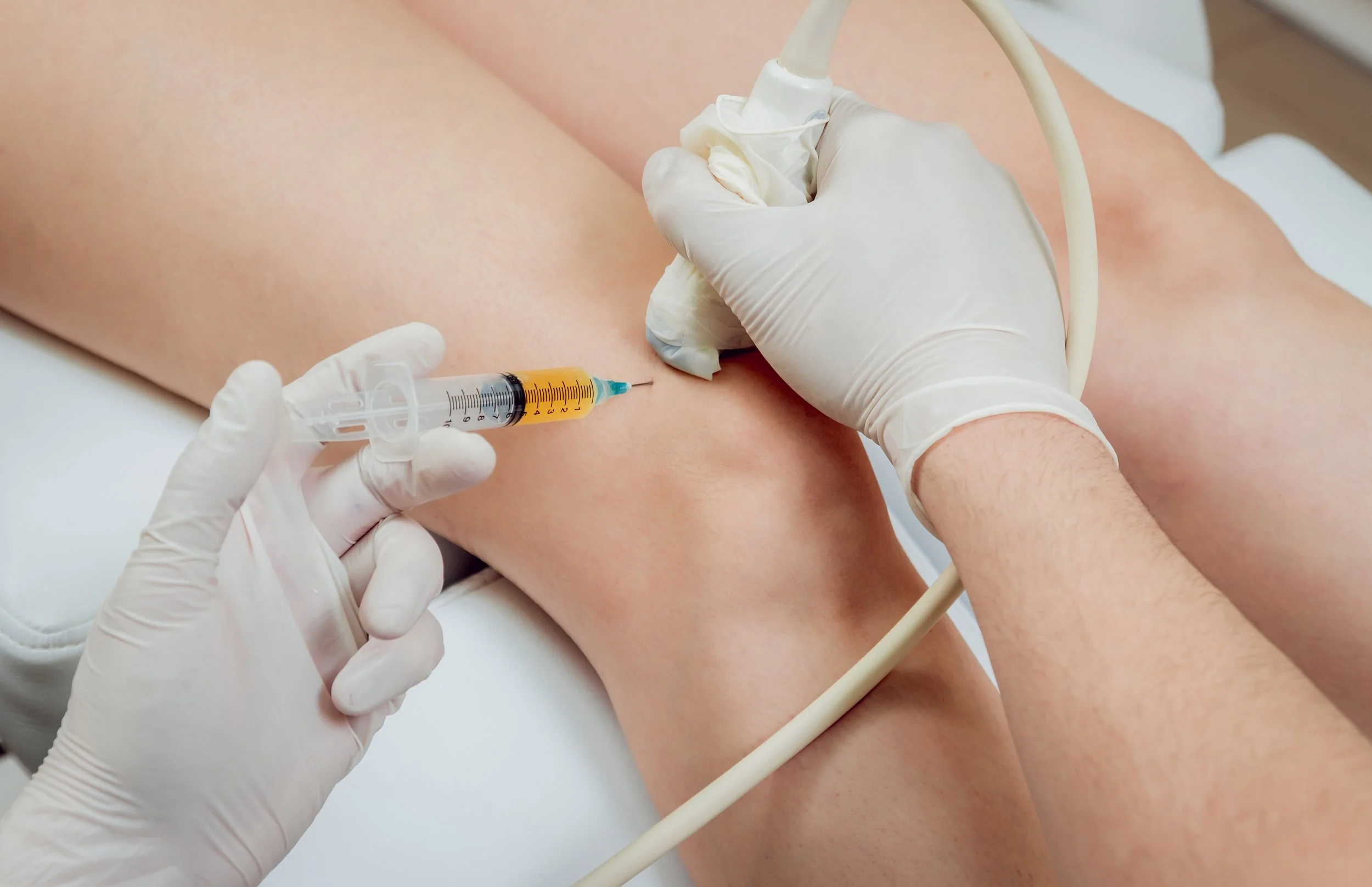 Plasma rico en plaquetas (PRP): ¿qué es y cuándo funciona mejor? (copia)