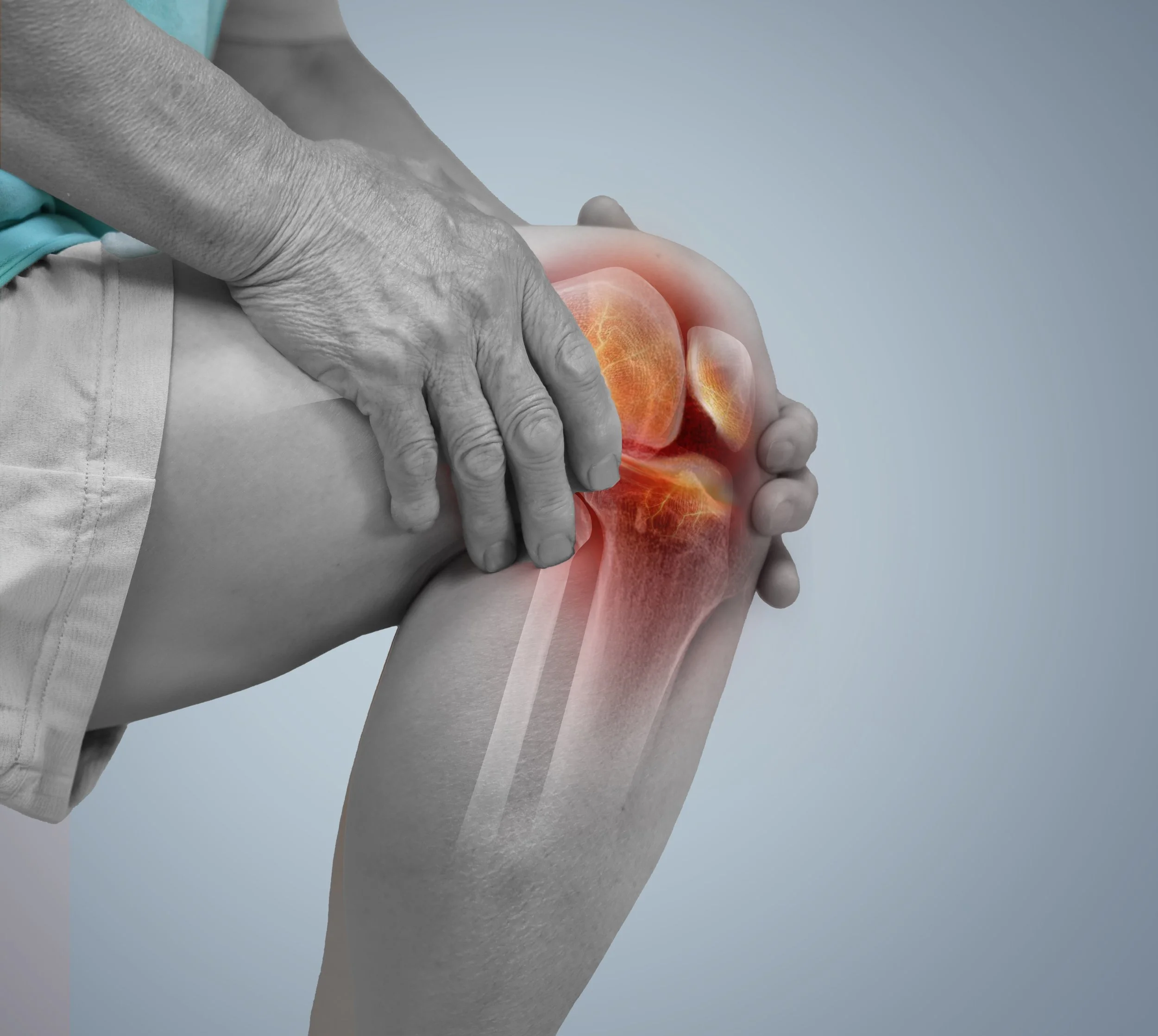 Artrosis de rodilla: síntomas y opciones de tratamiento