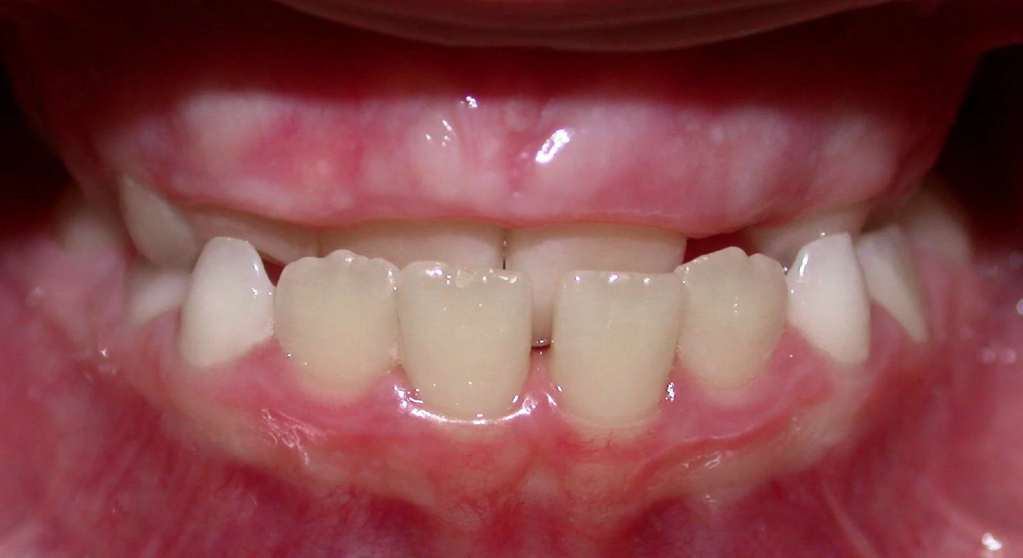 1. Max Deficient Abigail Harman 4-11-02.jpg