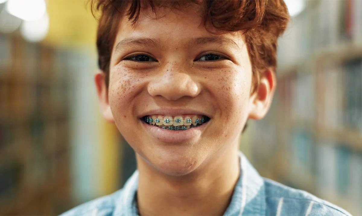 Your First Month with Braces: A Parent's Guide to What's Normal and What Comes Next