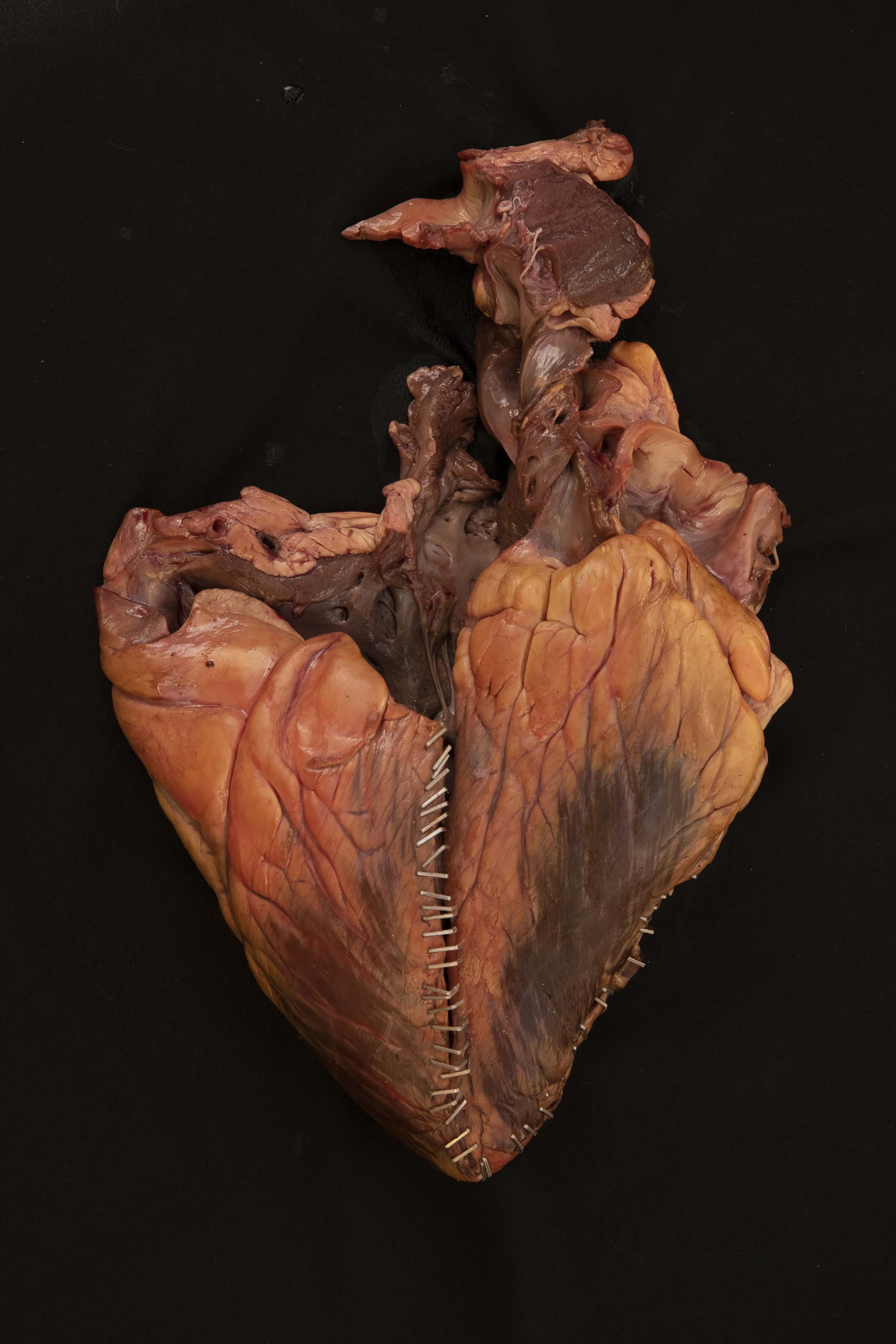 27StapledHeart.jpg