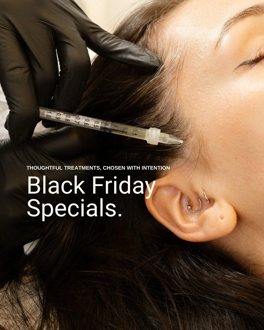 Our Black Friday offerings have arrived early.  A moment to replenish, renew, and prepare for the season ahead.

✨ Platelet Rich Fibrin (PRF). A familiar process, now refined for deeper rejuvenation and longer-lasting results.

- $800 single session 
