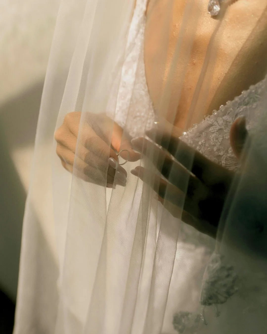 To those with a summer wedding on the horizon, this one is for you. We know how much thought goes into every detail of your day. Your skin deserves the same intention.

The thing most brides do not realize is that the treatments that make the biggest