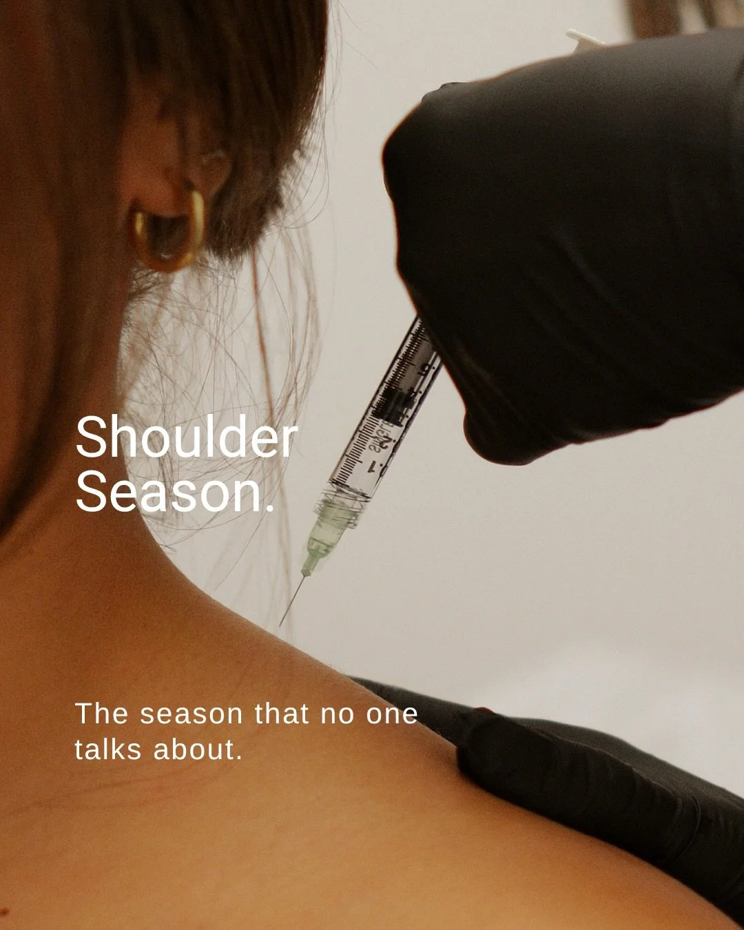Shoulder season&mdash;the one nobody talks about until it is too late.

Traptox places neuromodulators in the upper trapezius muscle. Many patients describe it working on two levels. A softer, longer-looking shoulder line, and a release of the chroni