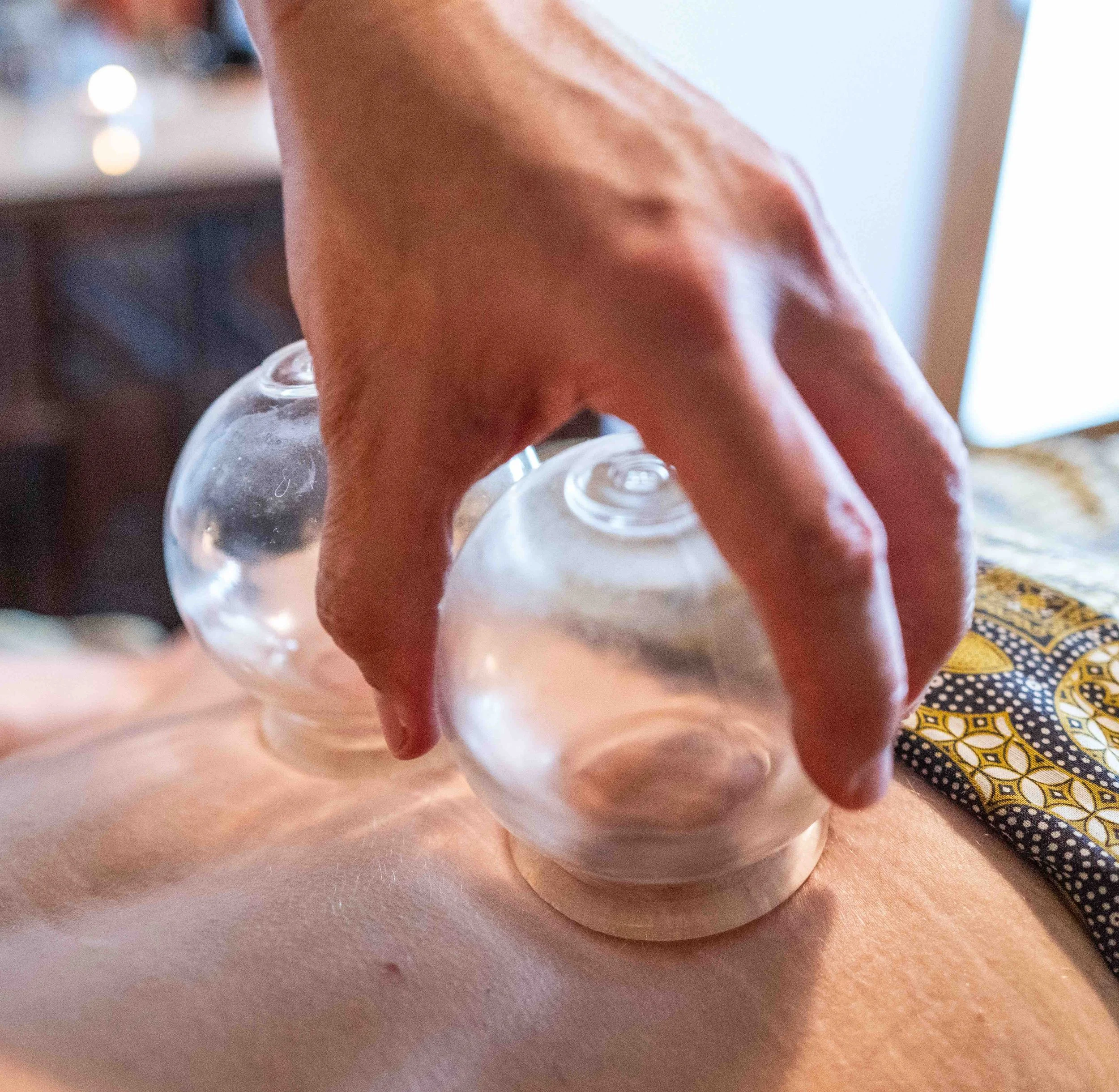 Glass cupping jars placed on back during cupping massage treatment to boost circulation