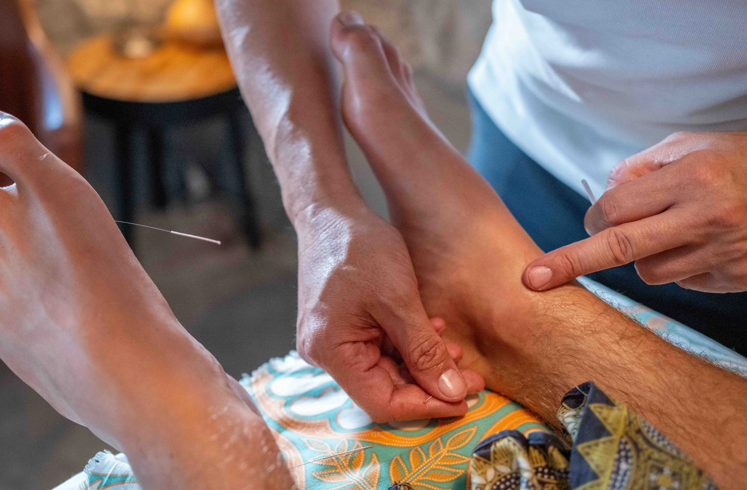 Acupuncturist inserting needle into foot during treatment for pain relief and wellness