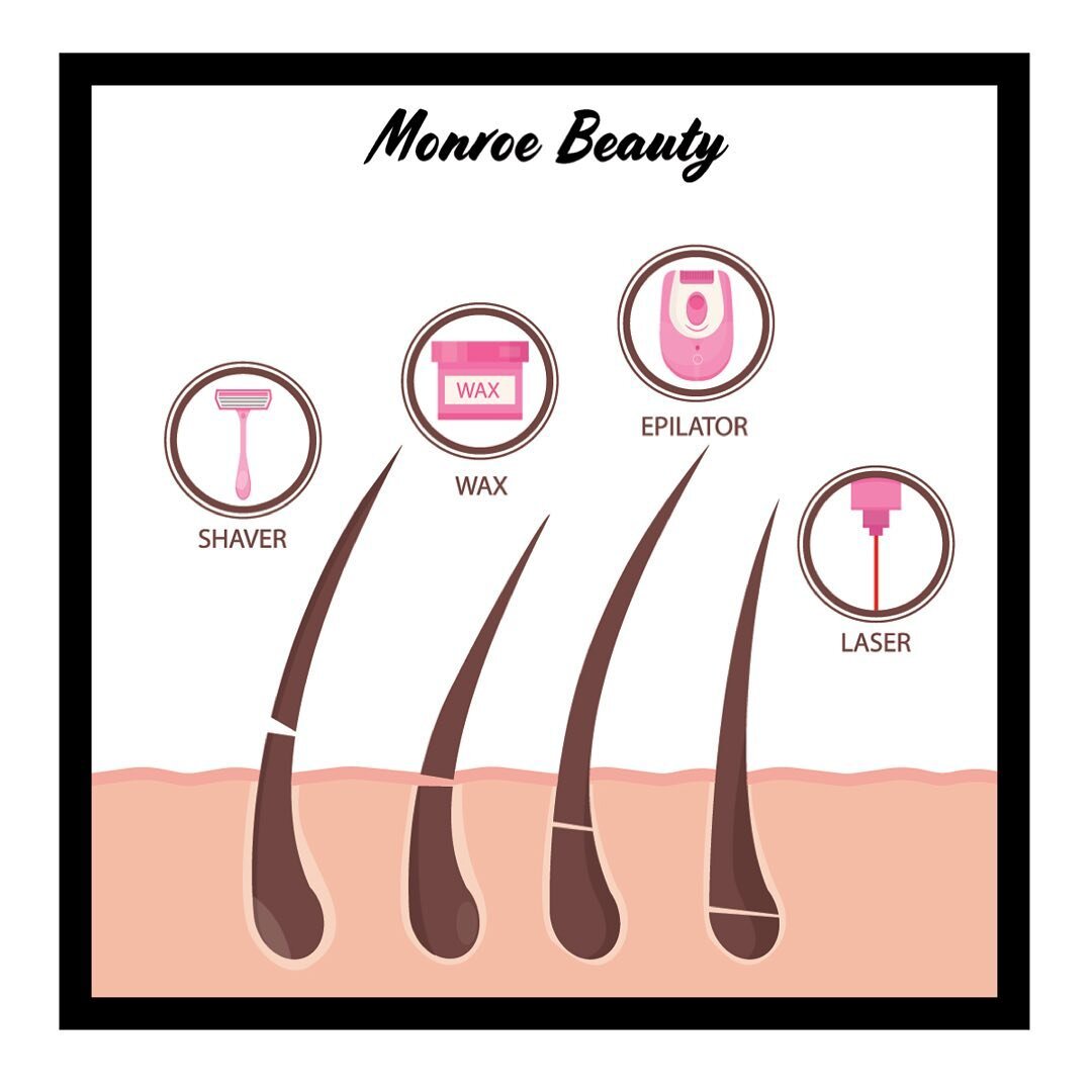 Do you suffer with ingrown hairs? 

Laser Hair Removal is the most effective treatment for getting rid of ingrown hairs. This is because the Laser targets the ROOT of the problem! 

Get in touch today by heading to our website, or calling us to discu