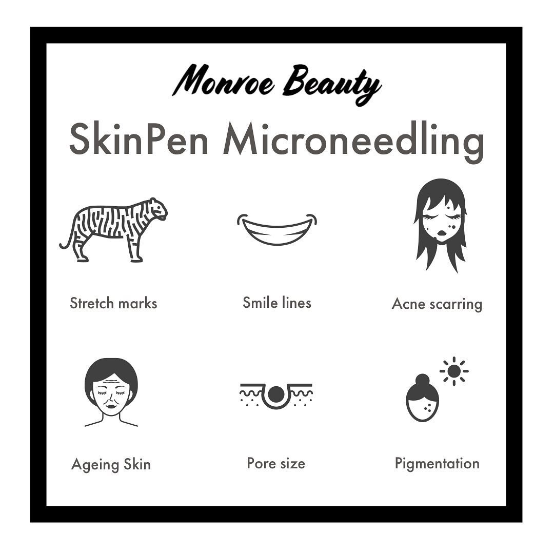 SkinPen has several tiny needles at the tip of it that move up and down to create micro-tears on the surface of your skin.

This controlled injury to your skin triggers your body to produce collagen and elastin to assist with healing. This extra coll