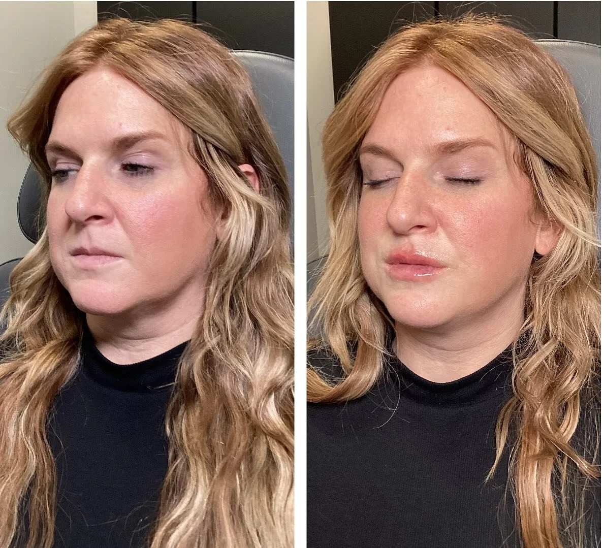 Look at the difference lip filler can make! The balance is so beautiful. Just enough and not to much. We are both so happy! 
Book your lip makeover today! 
💻 myconfidencelab.com
📱614.219.9983

Injector: Anna Castellanos, APRN-CNP