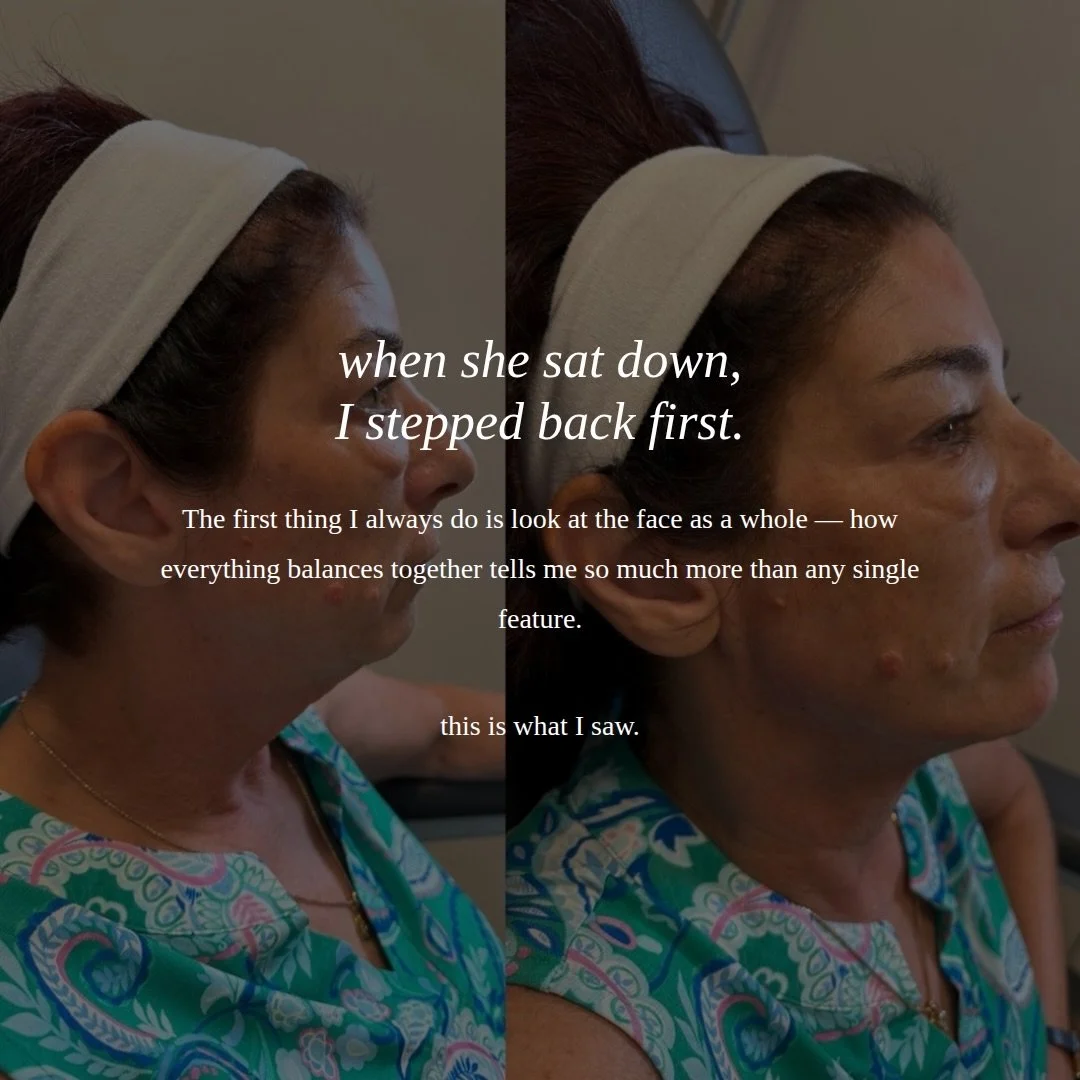 This is what I see before I ever pick up a syringe.

When I assess a face, I step back and look at it as a whole &mdash; not just lines or volume alone.

I&rsquo;m evaluating structure, bone position, soft tissue, facial proportions, and how each are