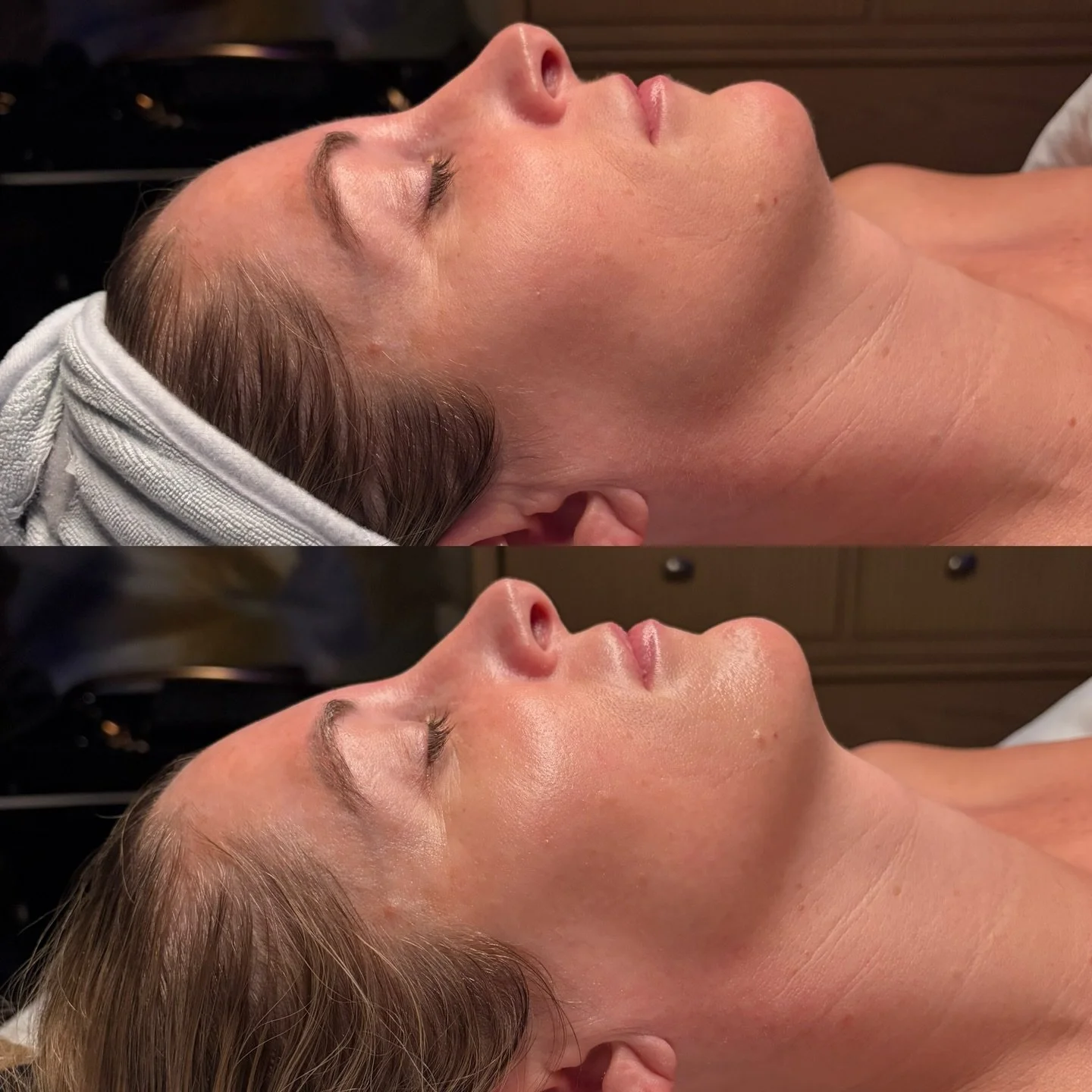 Before and After:

Anti-aging facial, lash lift in tint

.
.
Powell, Ohio 📍 
.
#Theconfidencelab