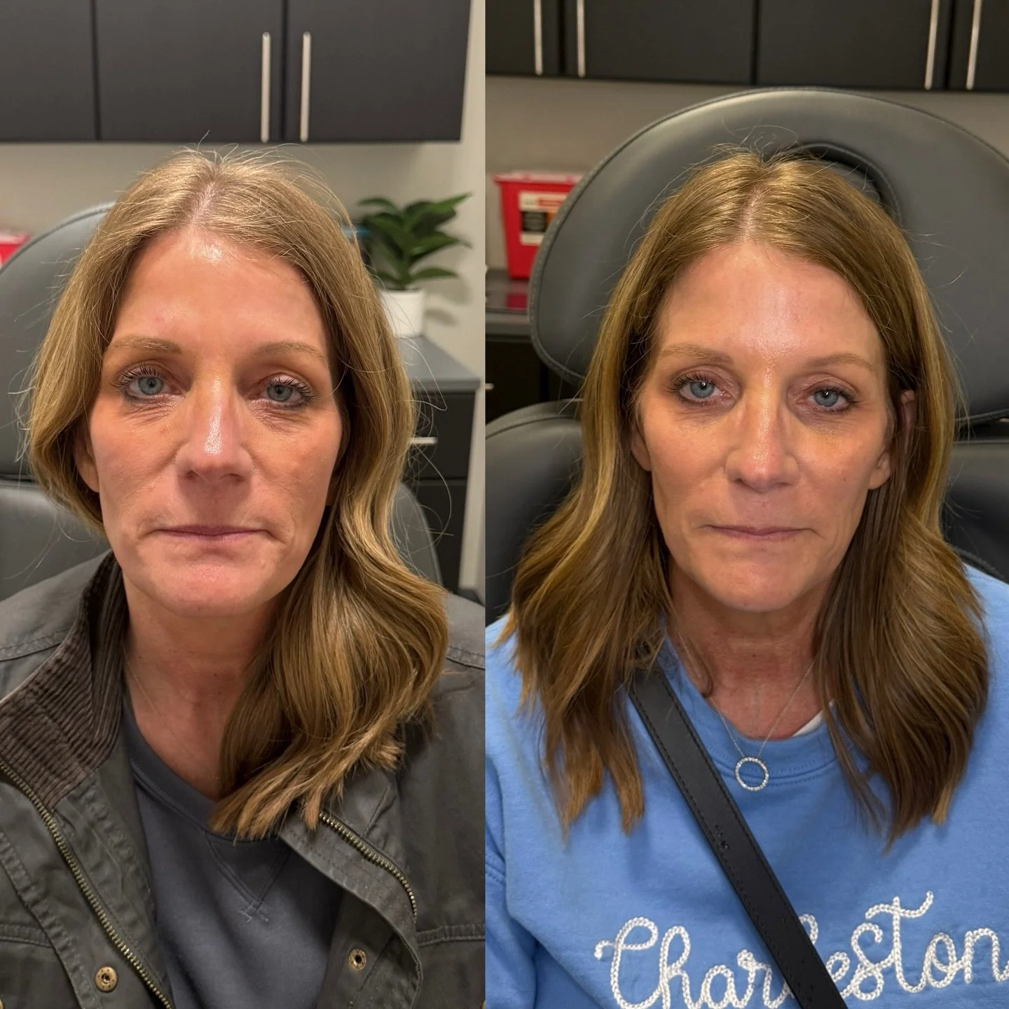 Completely refreshed. 👌

Sometimes the most beautiful results aren&rsquo;t dramatic &mdash; they&rsquo;re the subtle changes that make someone look more rested, balanced, and refreshed.

&ndash; Ashley Williamson, APRN-CNP

Schedule your summer refr