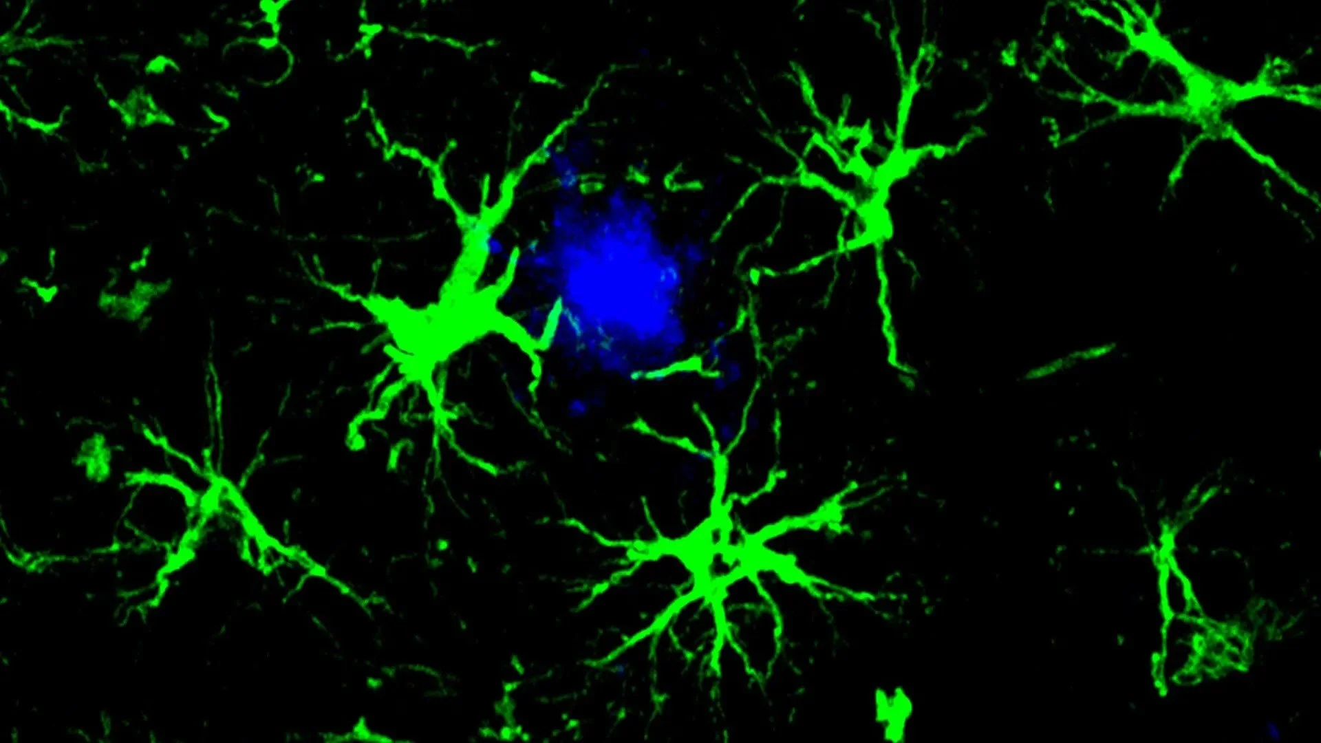 New Immunotherapy Innovation Developed For Alzheimer's