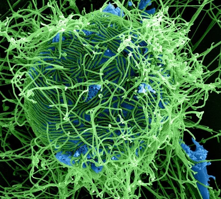 Ebola Cases in Africa See Recent Spike
