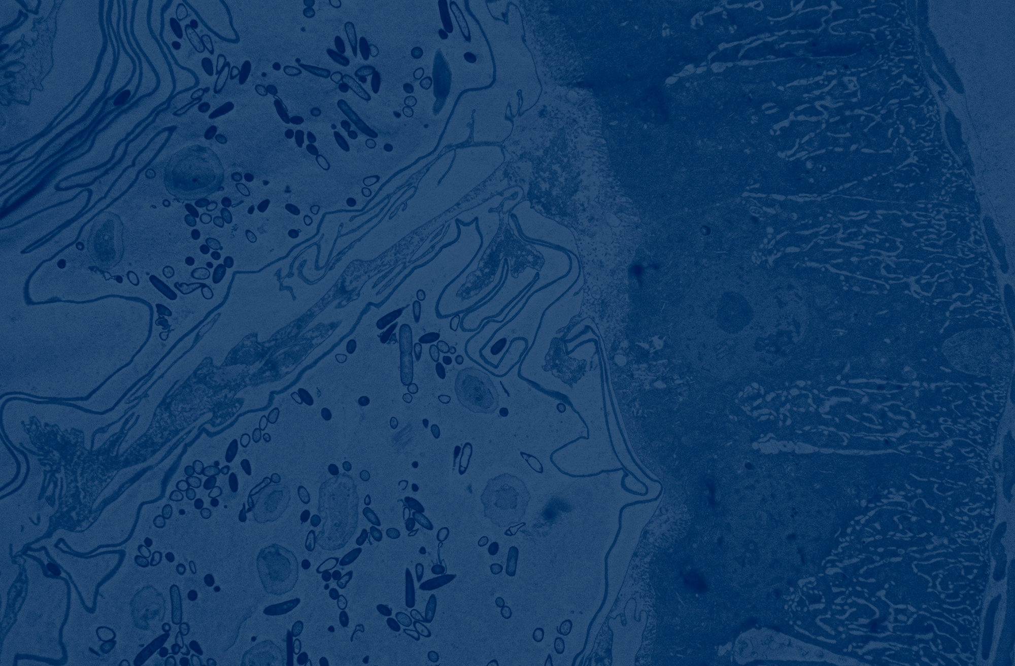 Cell Symposia: Gene and cell-based therapies: Progress in clinical translation