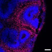 Alzheimer’s Disease Pathology and Potential Treatment Targets Identified in Brain Organoids