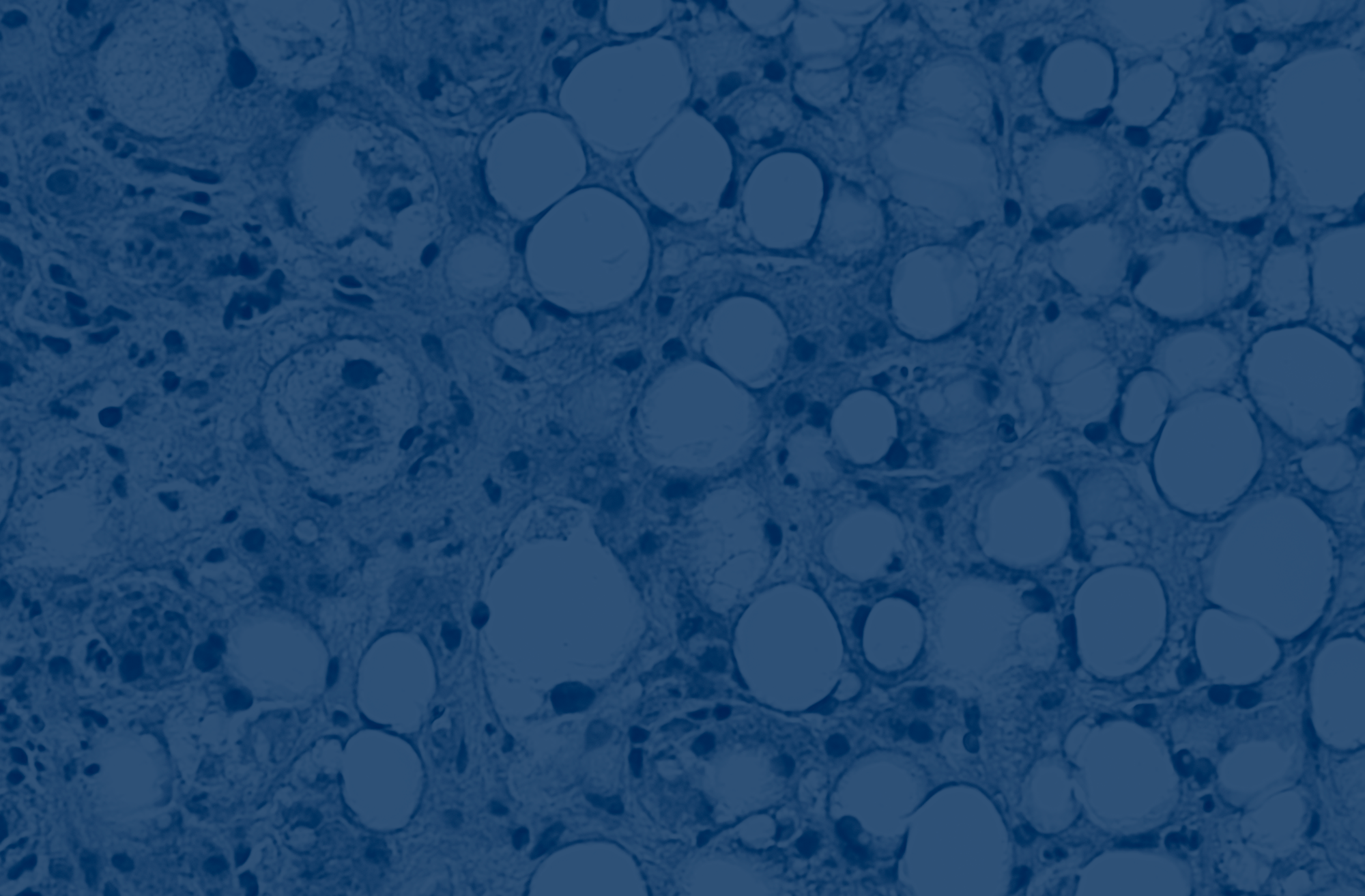 SDDS 2026: Stanford Drug Discovery Symposium