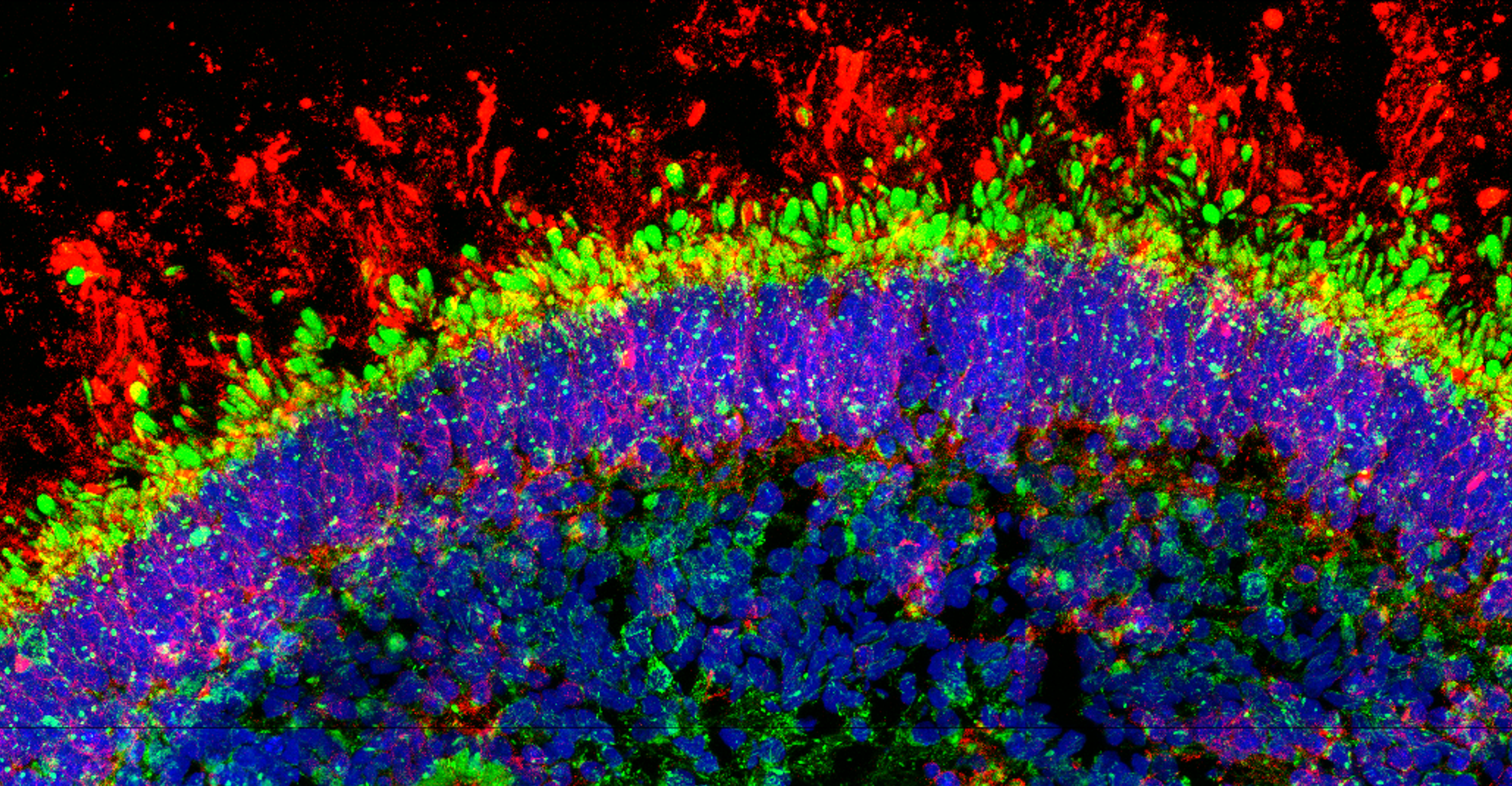 Retinal Organoid Platform Identifies Biomarkers and Affords Genetic Testing for Retinal Disease&nbsp;