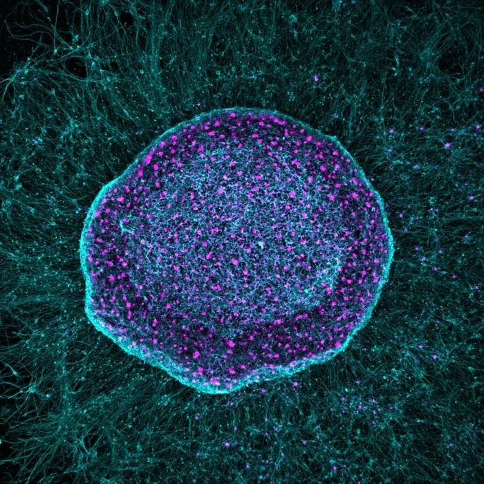 Non-opioid ‘Pain Sponge’ Therapy Halts Cartilage Degeneration and Relieves Chronic Pain