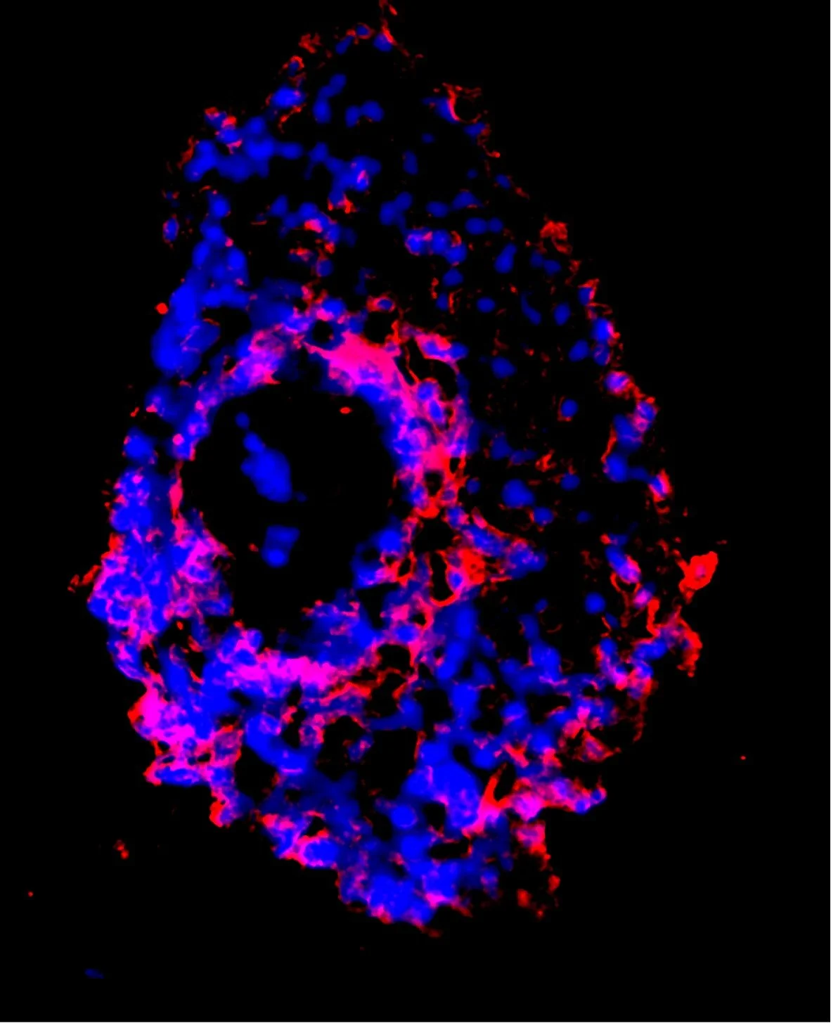 Insights Into Dry Eyes Gained from Stem cell-derived Tear Glands