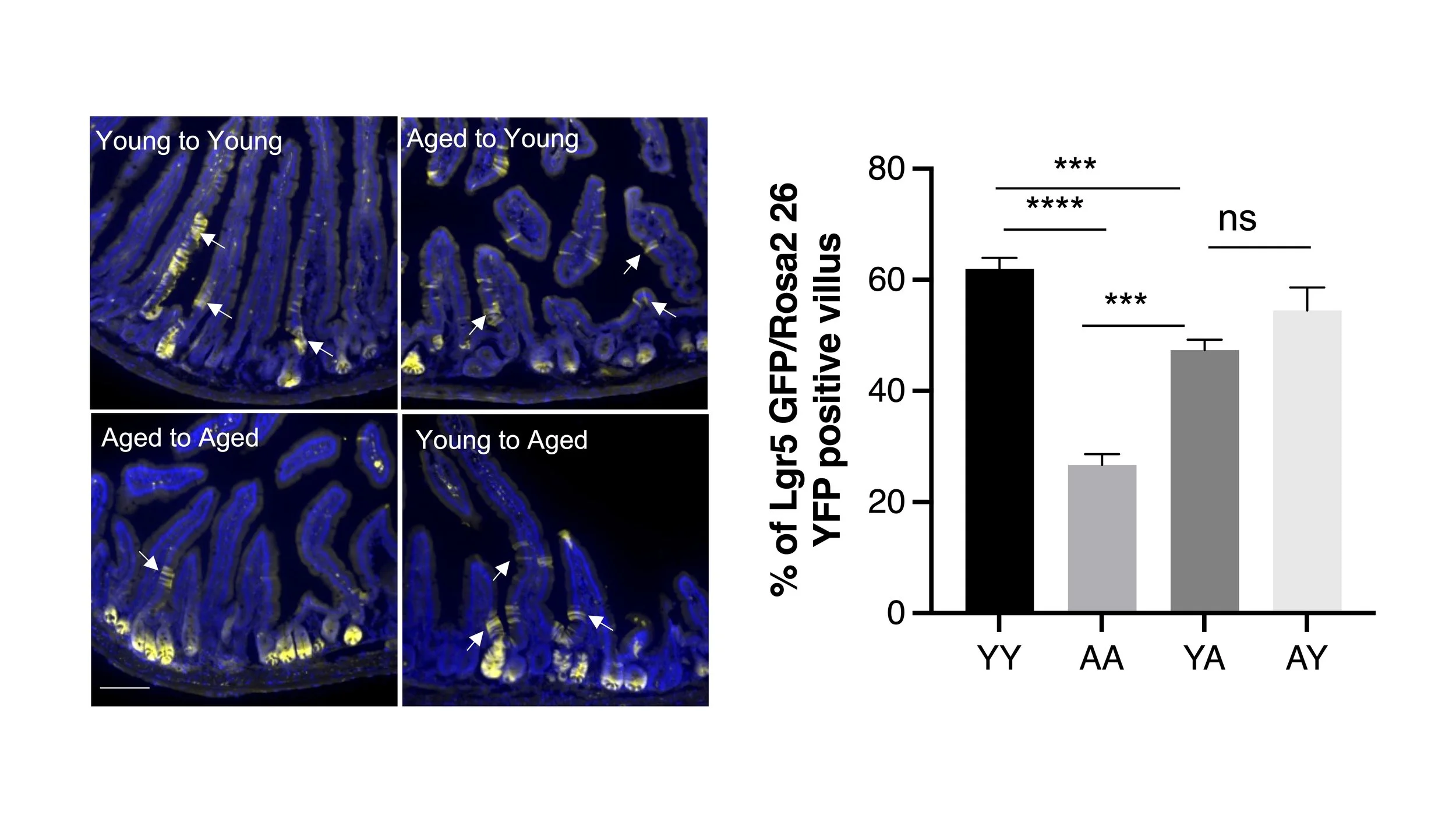 New Study Shows Gut Microbiota Directly Regulates Intestinal Stem Cell Aging