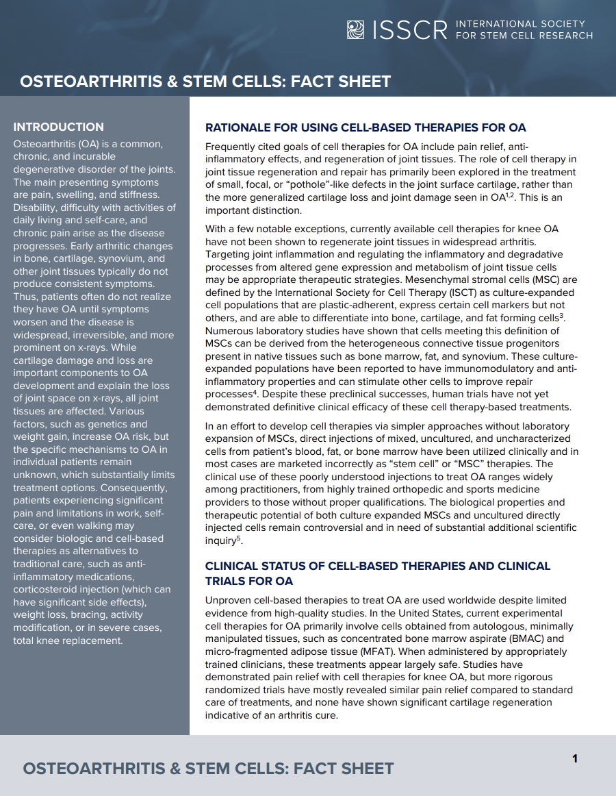 Disease Fact Sheet: Osteoarthritis (OA)